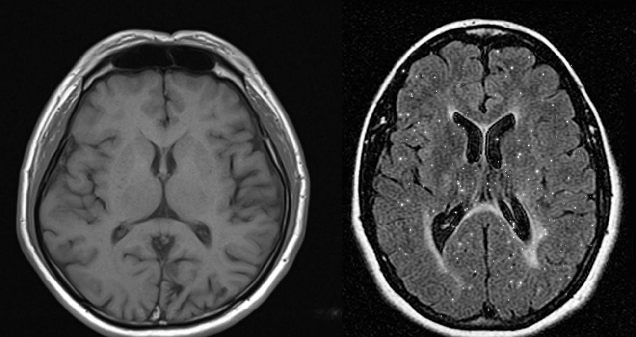My Recovery From Multiple Sclerosis campaign photo, 6 of 8