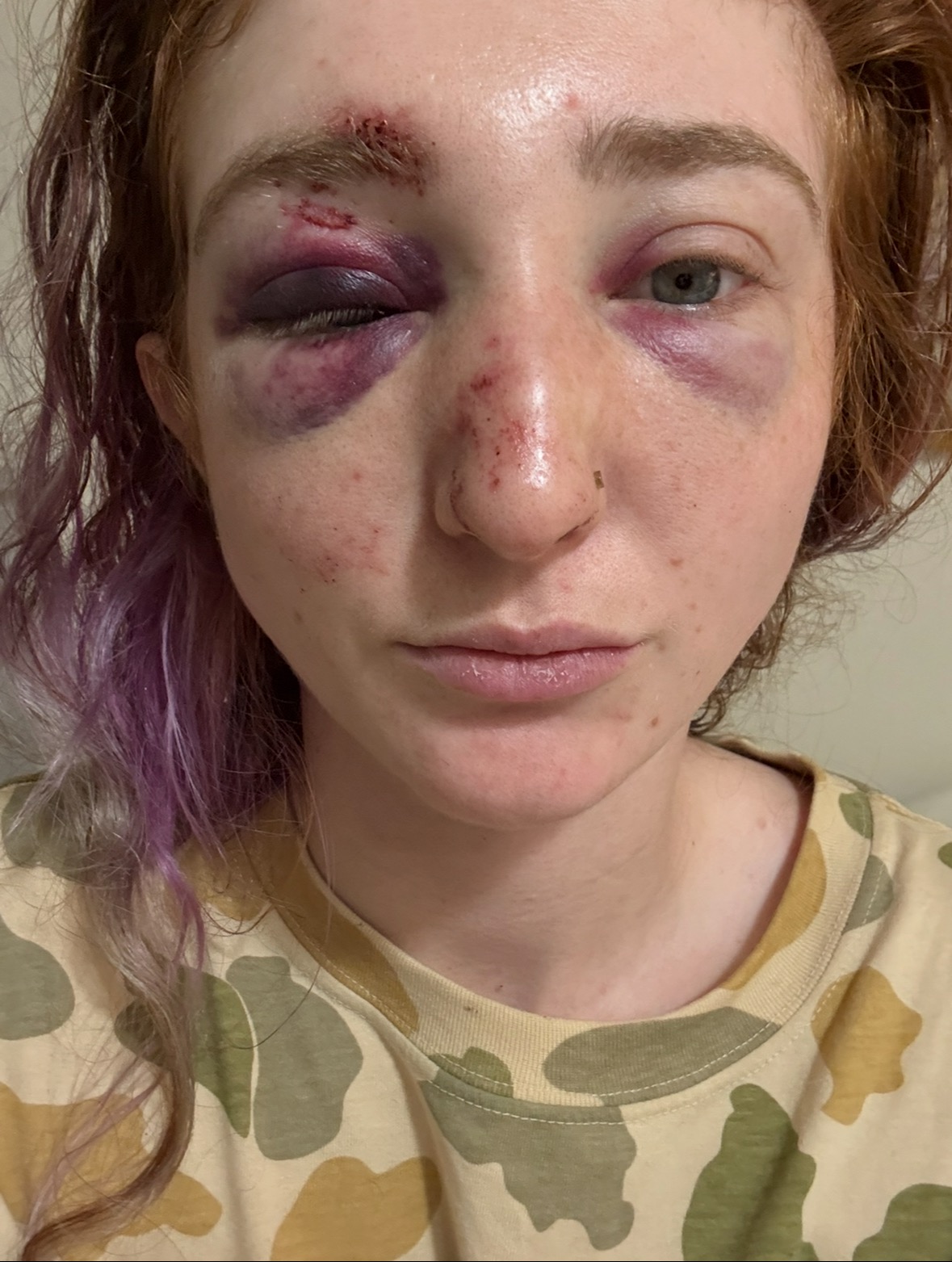 Donate to Cover Urgent Medical Expenses campaign photo, 5 of 8