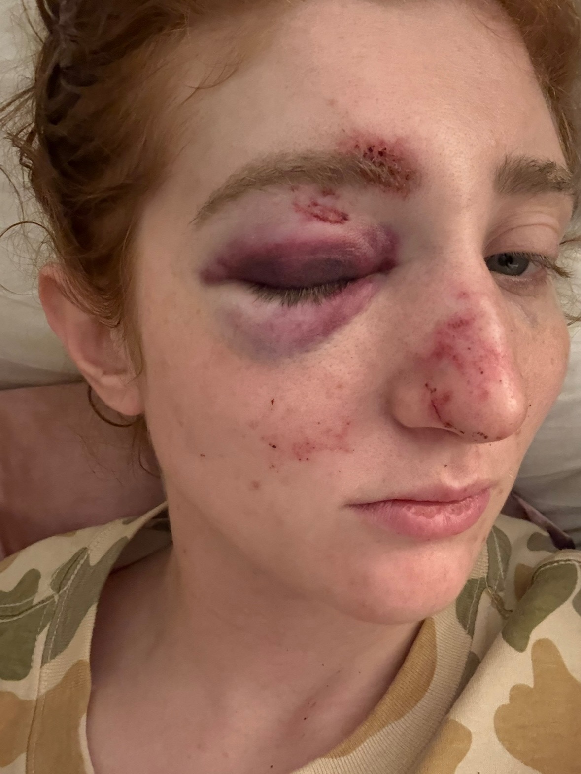 Donate to Cover Urgent Medical Expenses campaign photo, 6 of 8