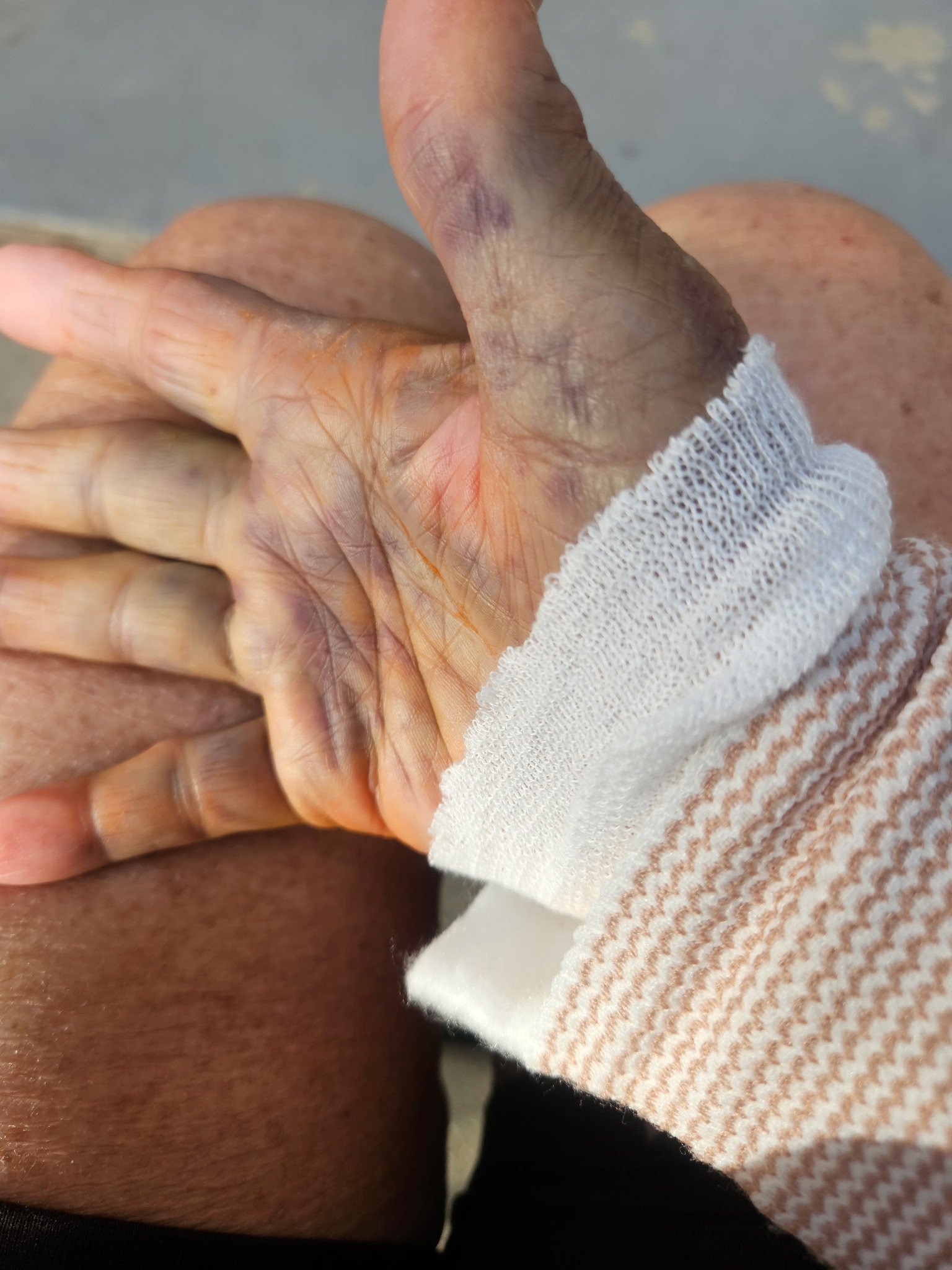 Help Anna Temple Recover from Elbow Surgery campaign photo, 7 of 8