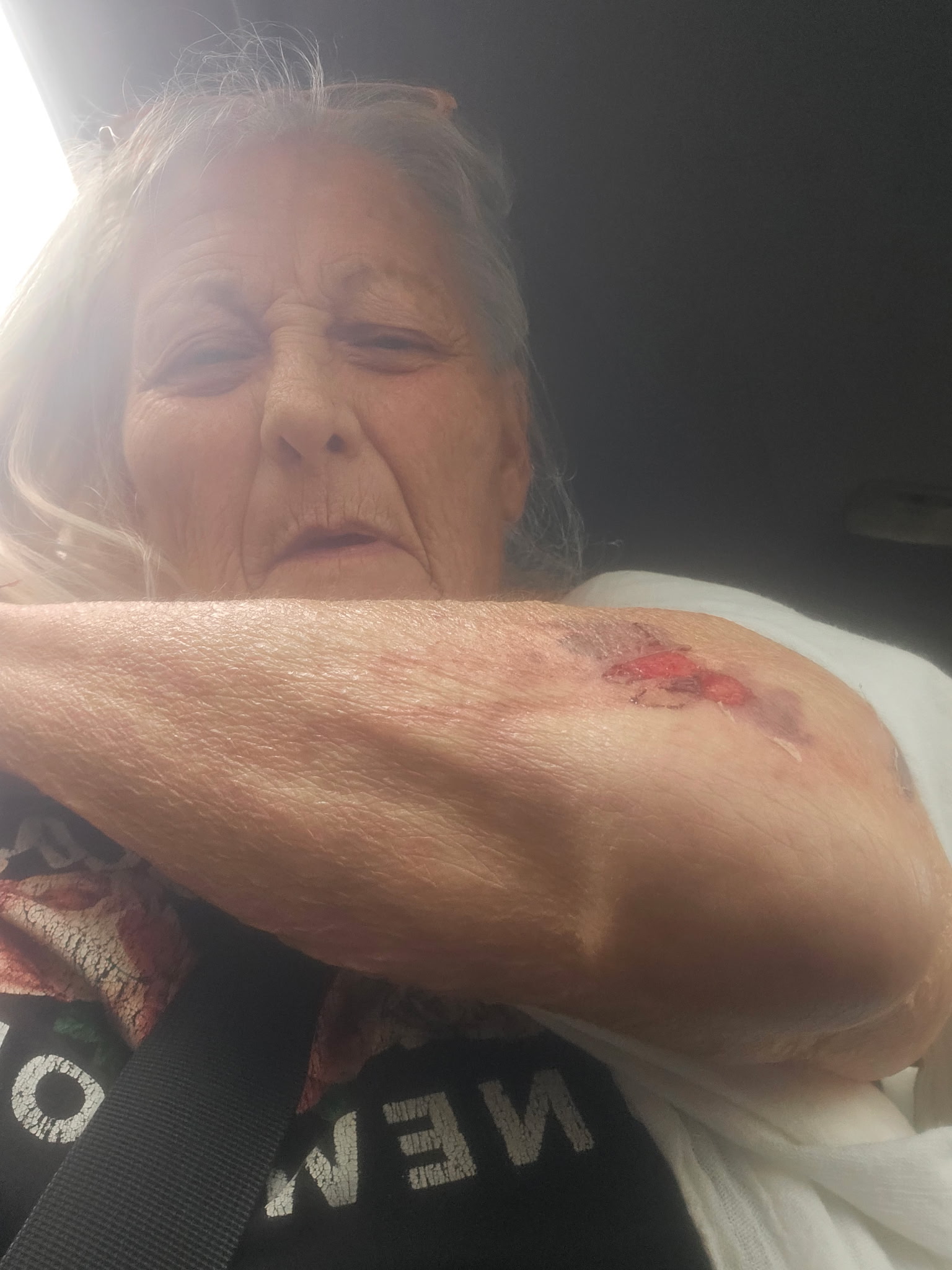 Help Anna Temple Recover from Elbow Surgery campaign photo, 5 of 8