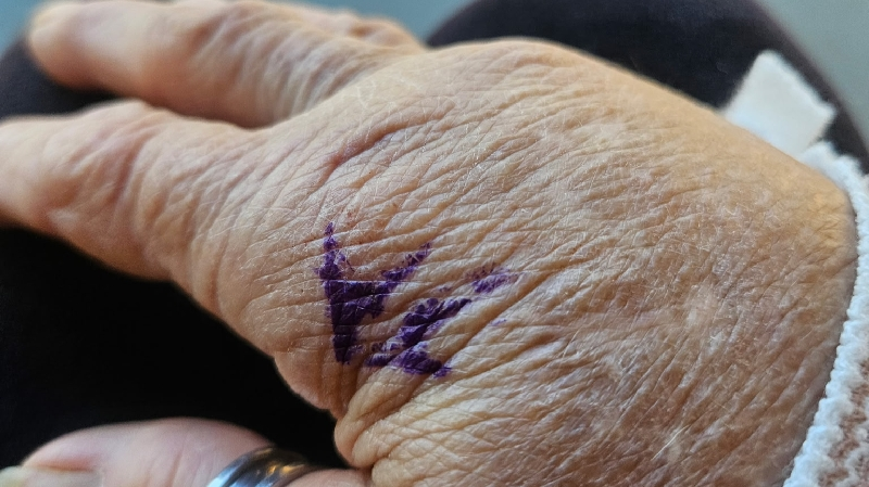 Help Anna Temple Recover from Elbow Surgery photo