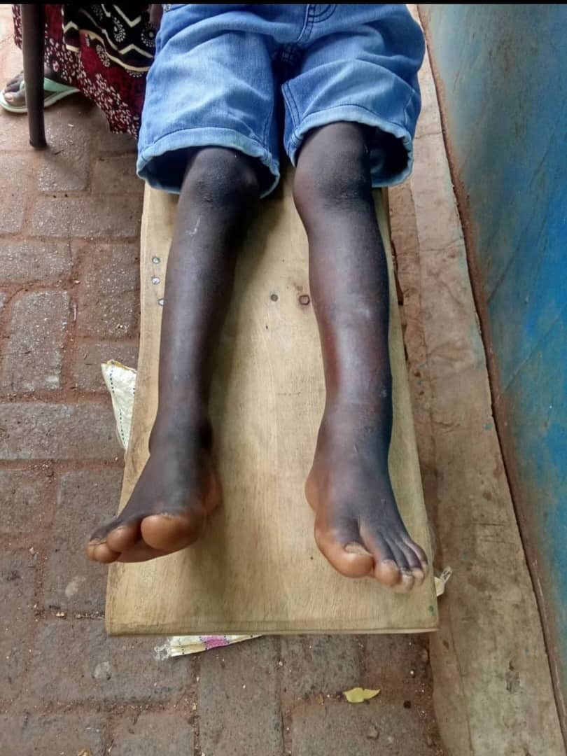 Hilfe für Familien und Patienten in Gambia – Lebensmittel campaign photo, 7 of 8