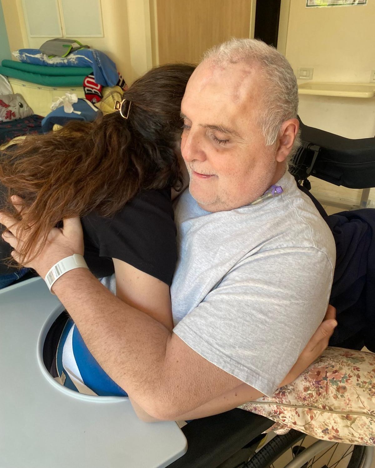 Controllo post operatorio di mastopessi con protesi, image size:1200x1500