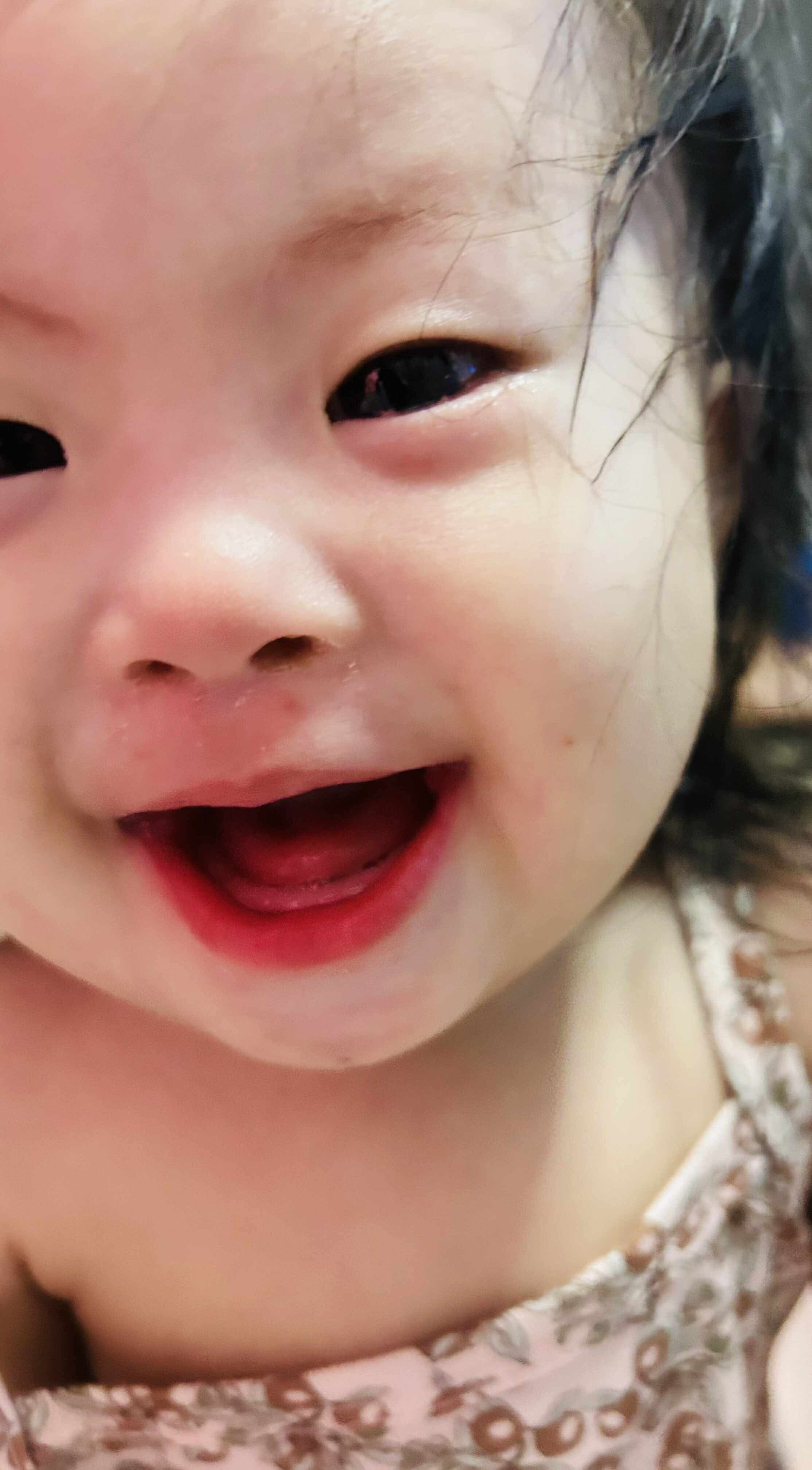 Support Juliana's Life-Saving Surgery campaign photo, 7 of 8