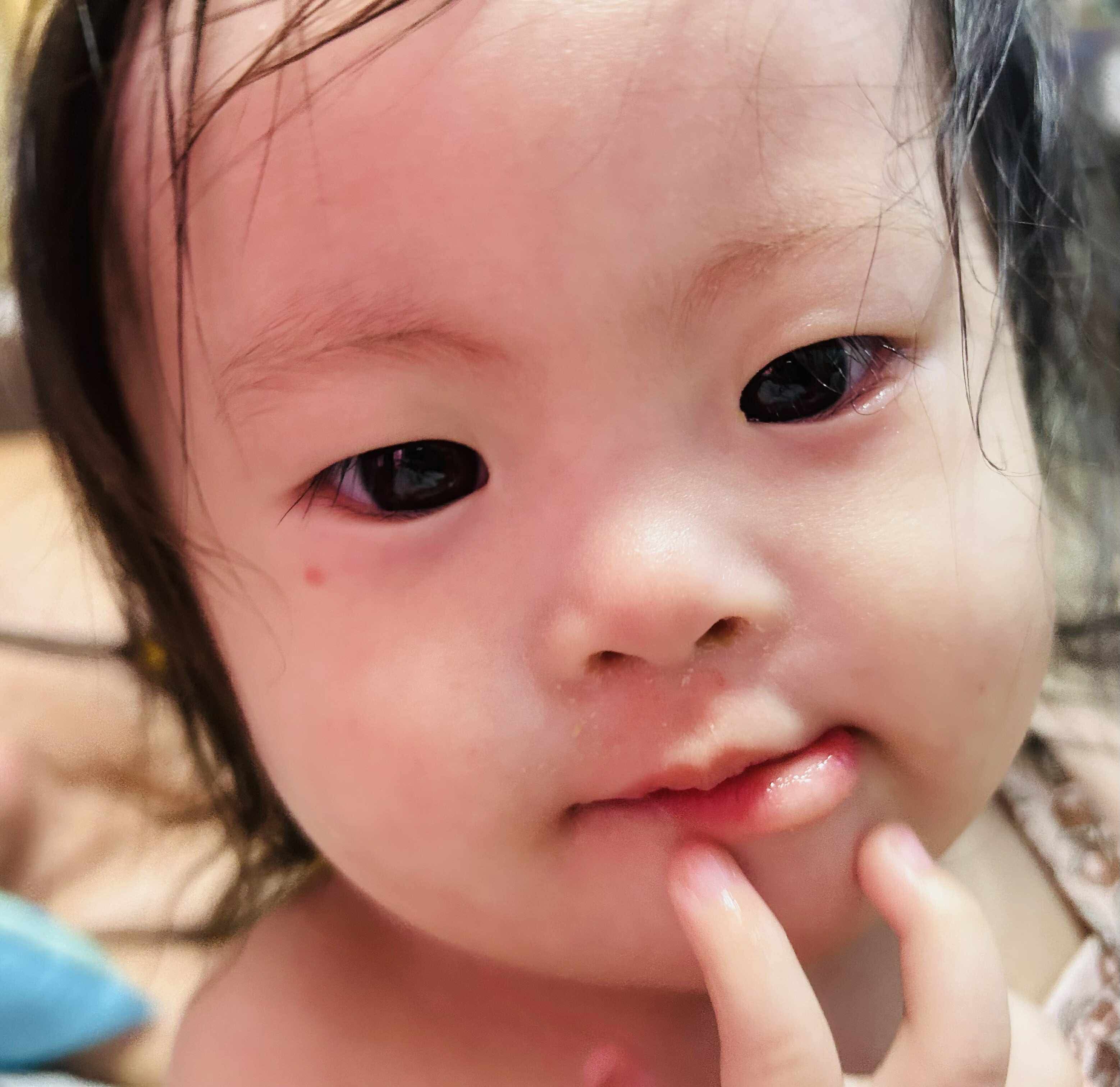 Support Juliana's Life-Saving Surgery campaign photo, 4 of 8