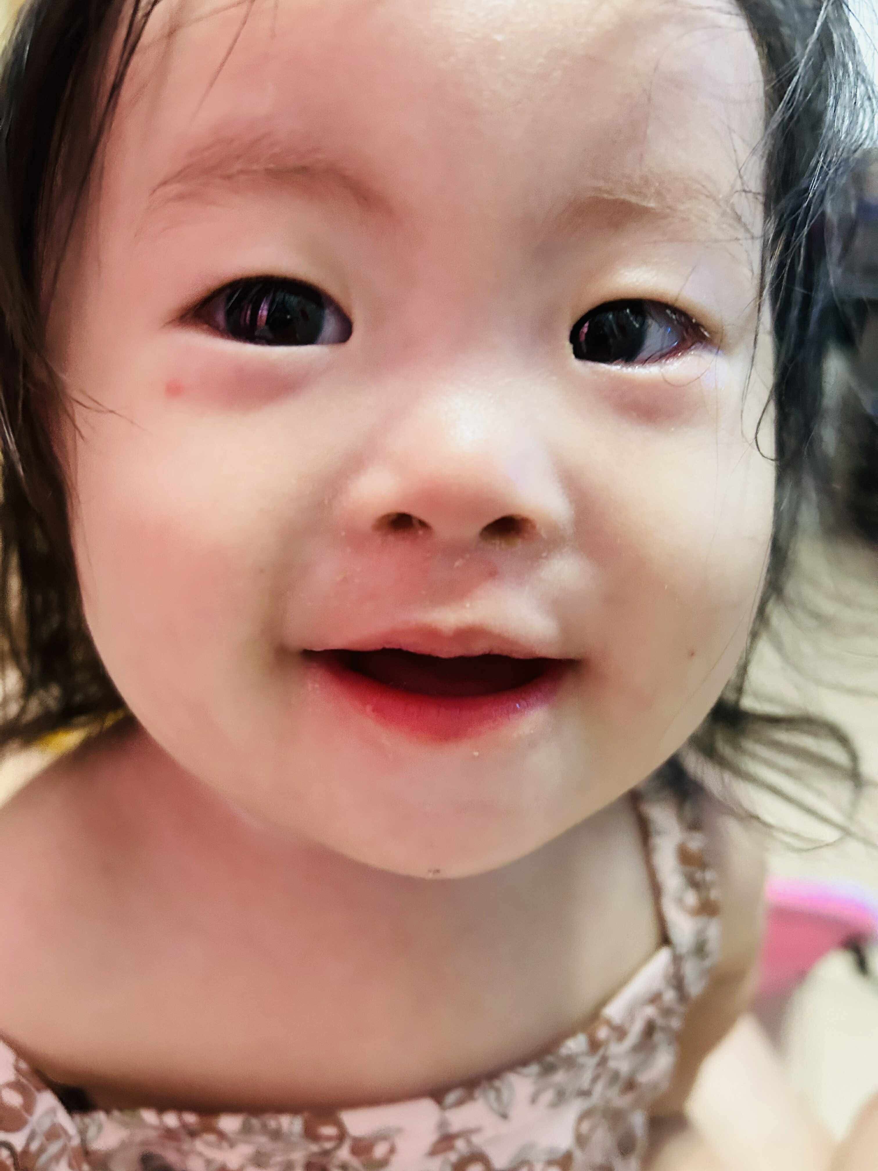 Support Juliana's Life-Saving Surgery campaign photo, 5 of 8