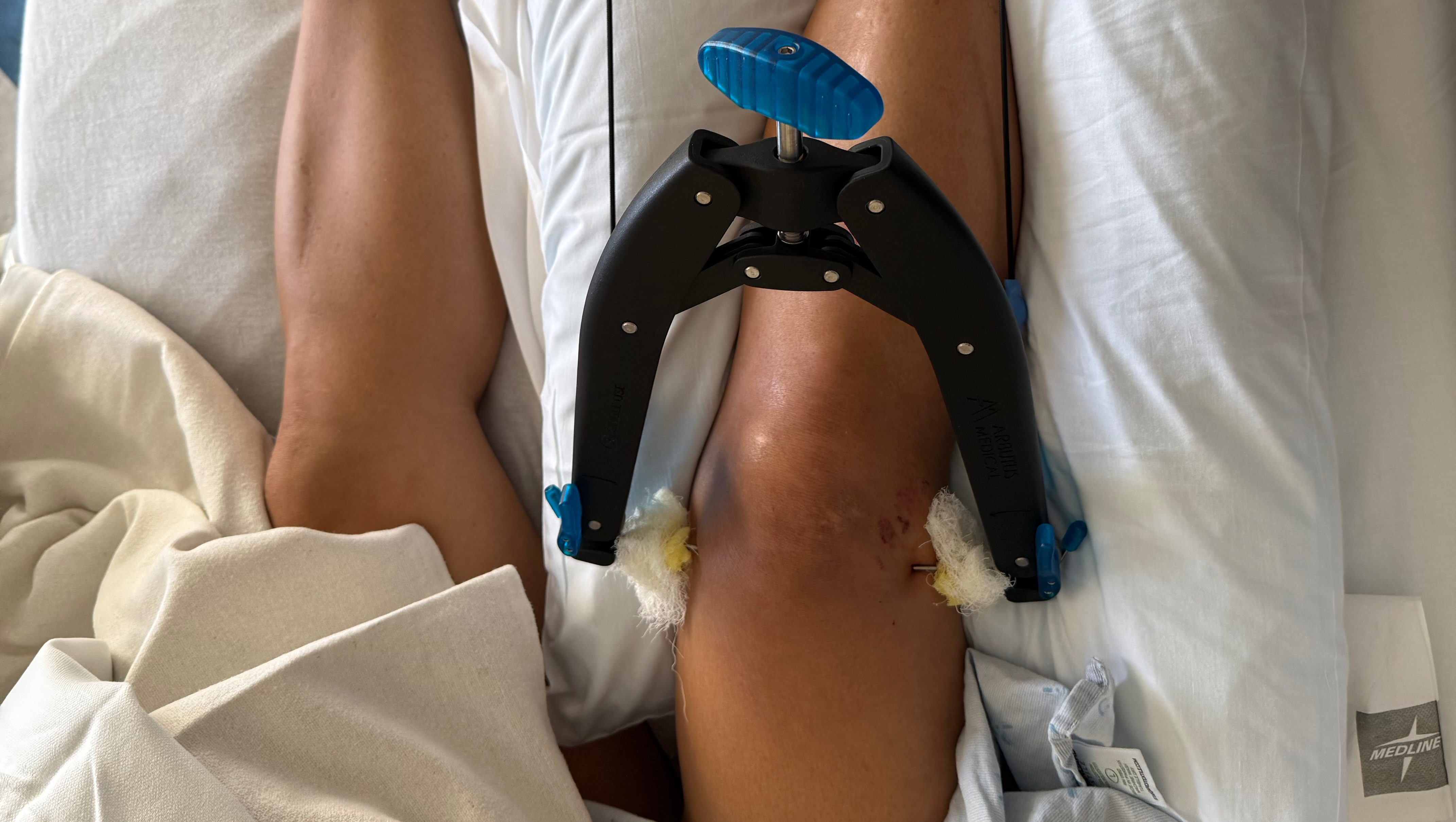 Support Diane Heal from severe injuries and Cover Medical Ex photo