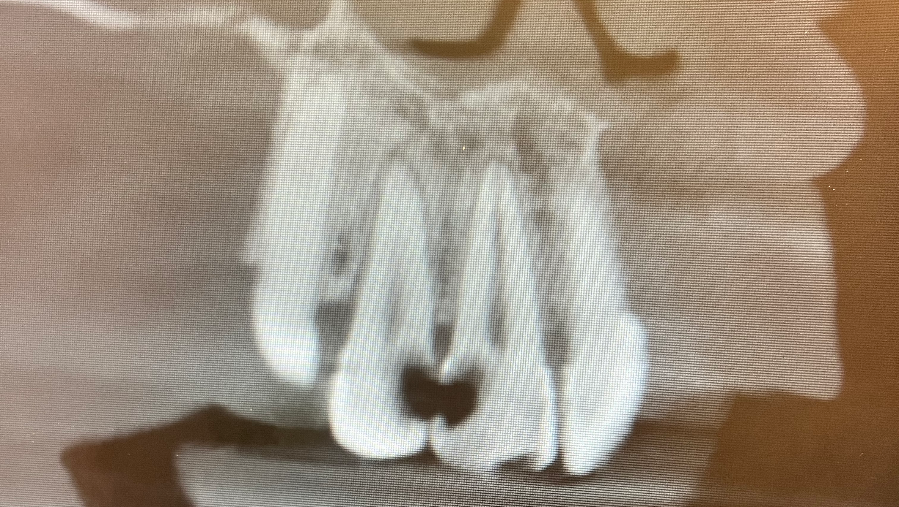 Help Ms. Bambii Smile Again — Urgent Dental Restoration Fund photo