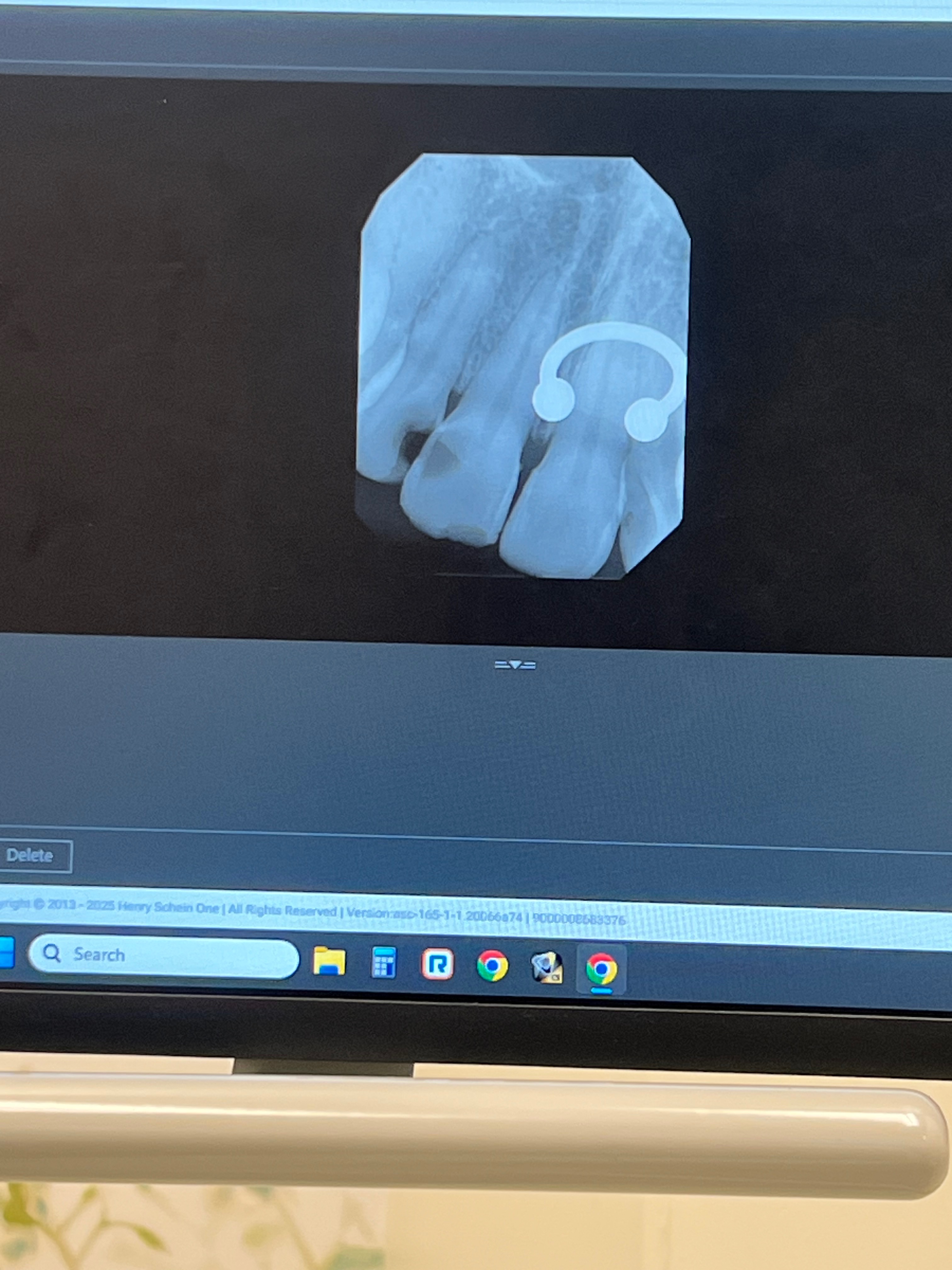 Help Ms. Bambii Smile Again — Urgent Dental Restoration Fund campaign photo, 7 of 8