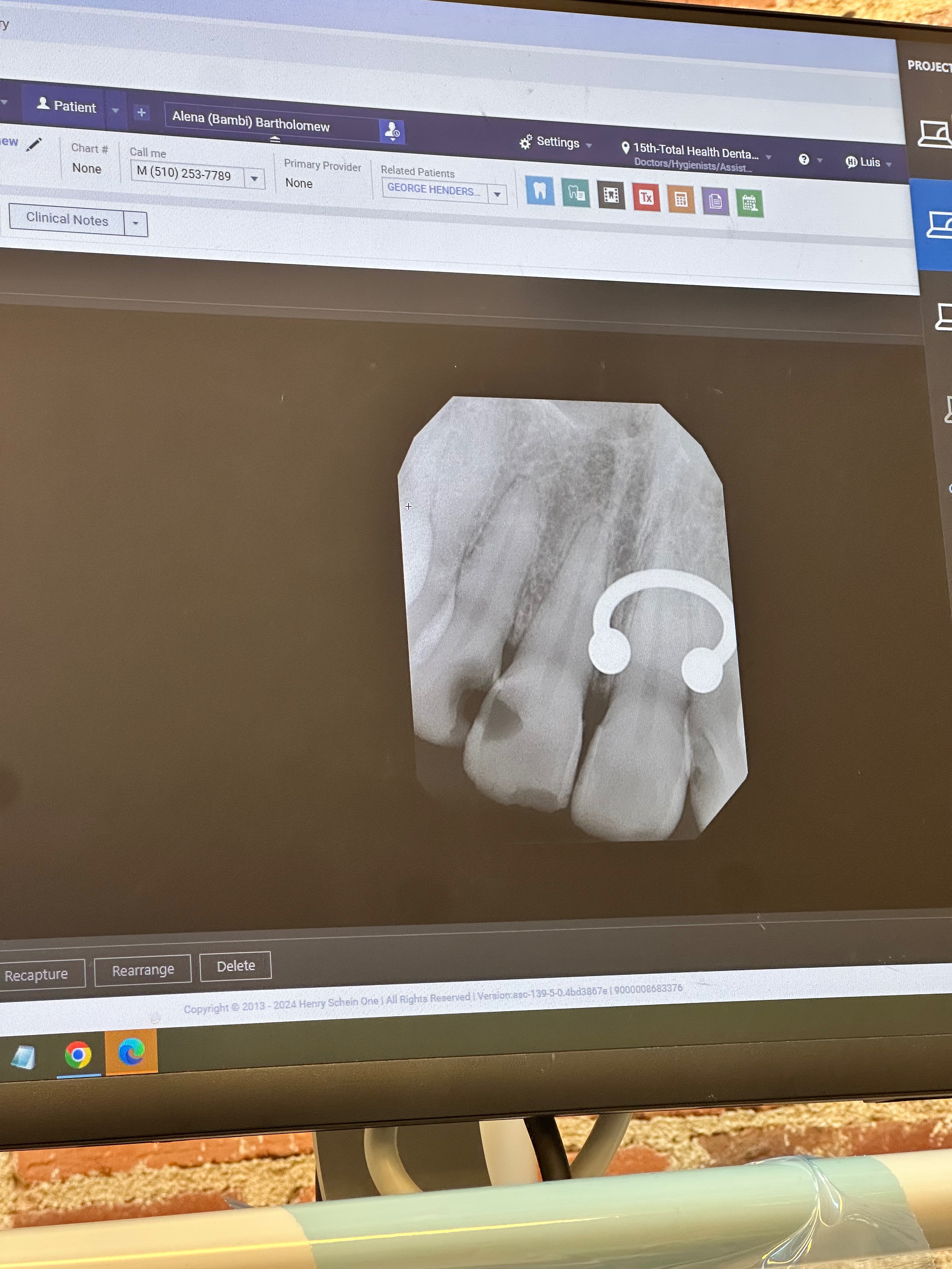 Help Ms. Bambii Smile Again — Urgent Dental Restoration Fund campaign photo, 2 of 8
