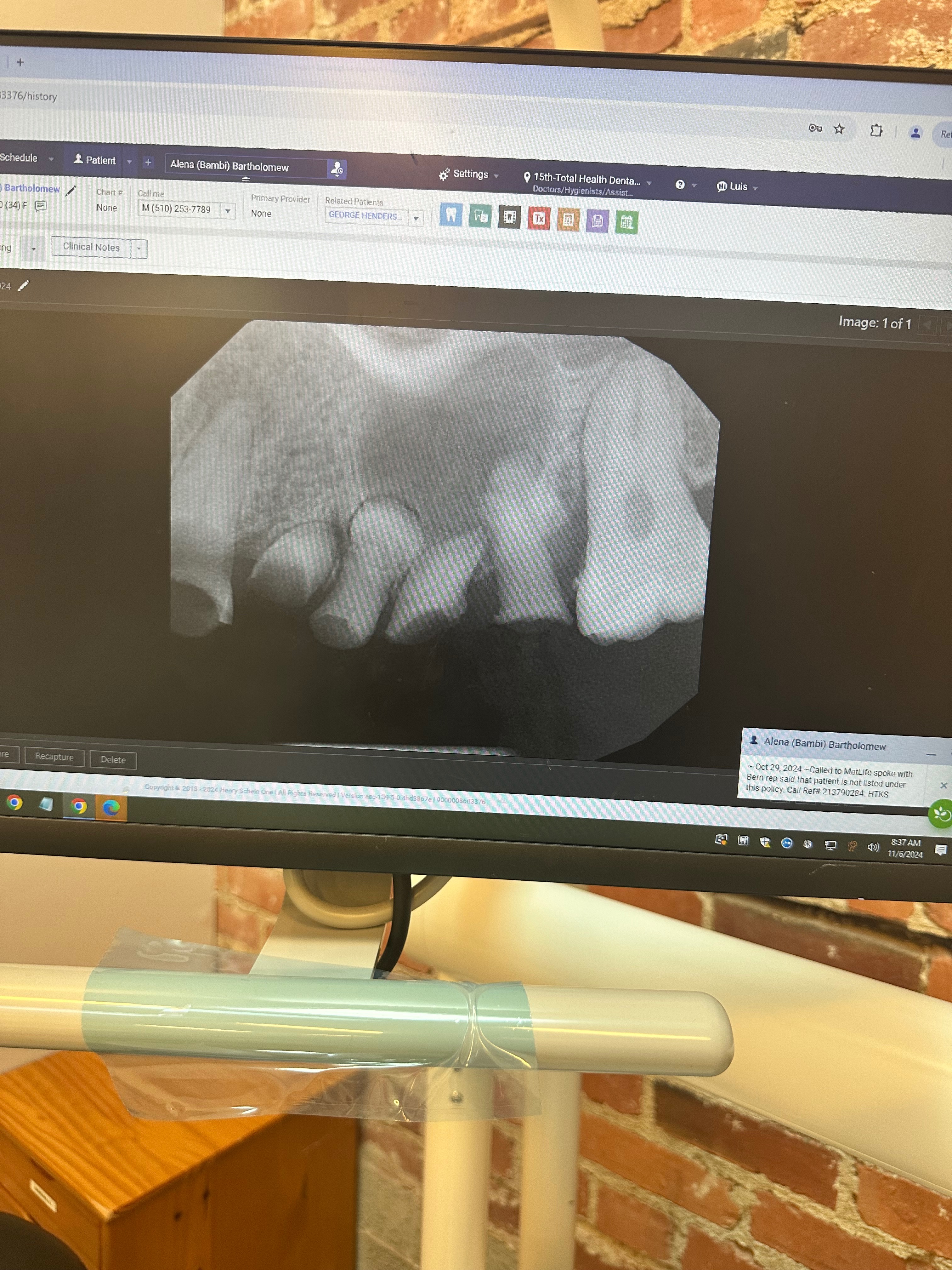 Help Ms. Bambii Smile Again — Urgent Dental Restoration Fund campaign photo, 4 of 8