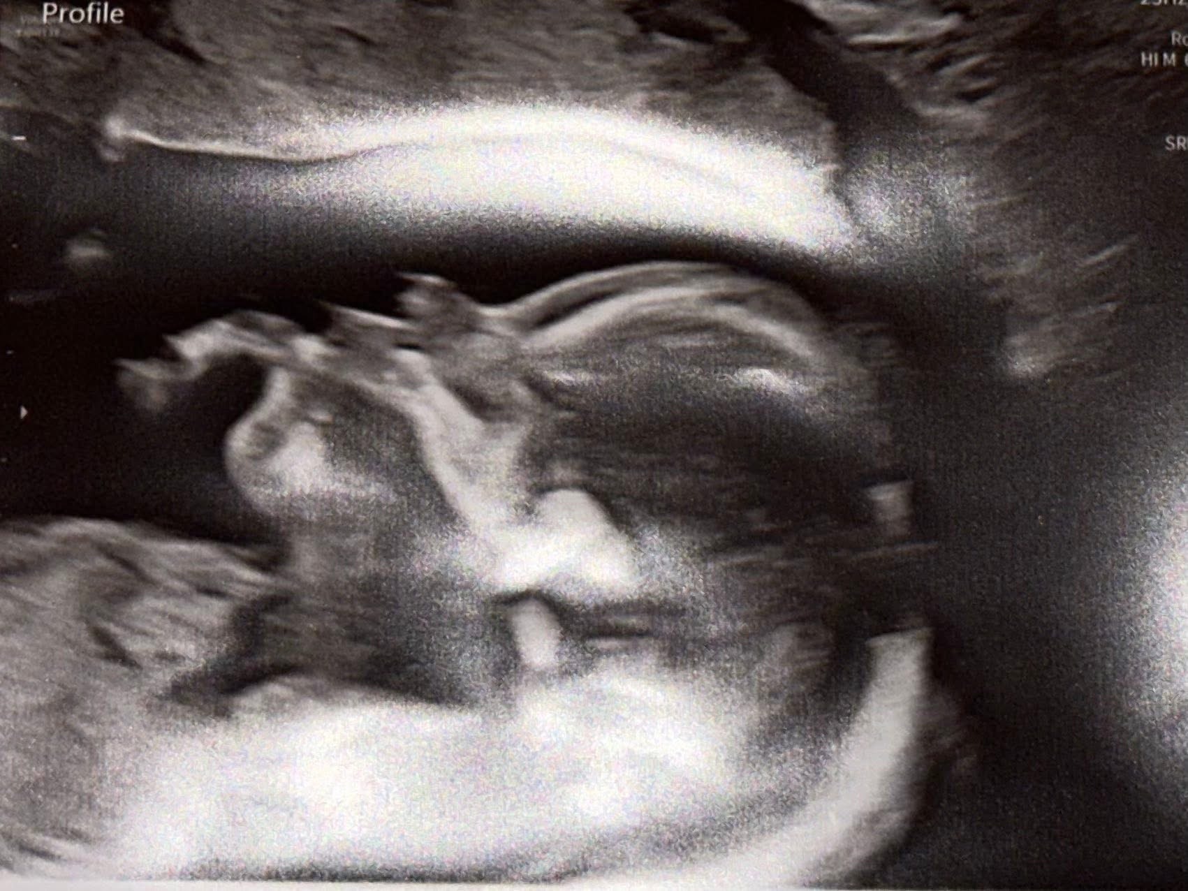 Help LaTosha Through Her High-Risk Pregnancy & NICU Journey campaign photo, 5 of 8