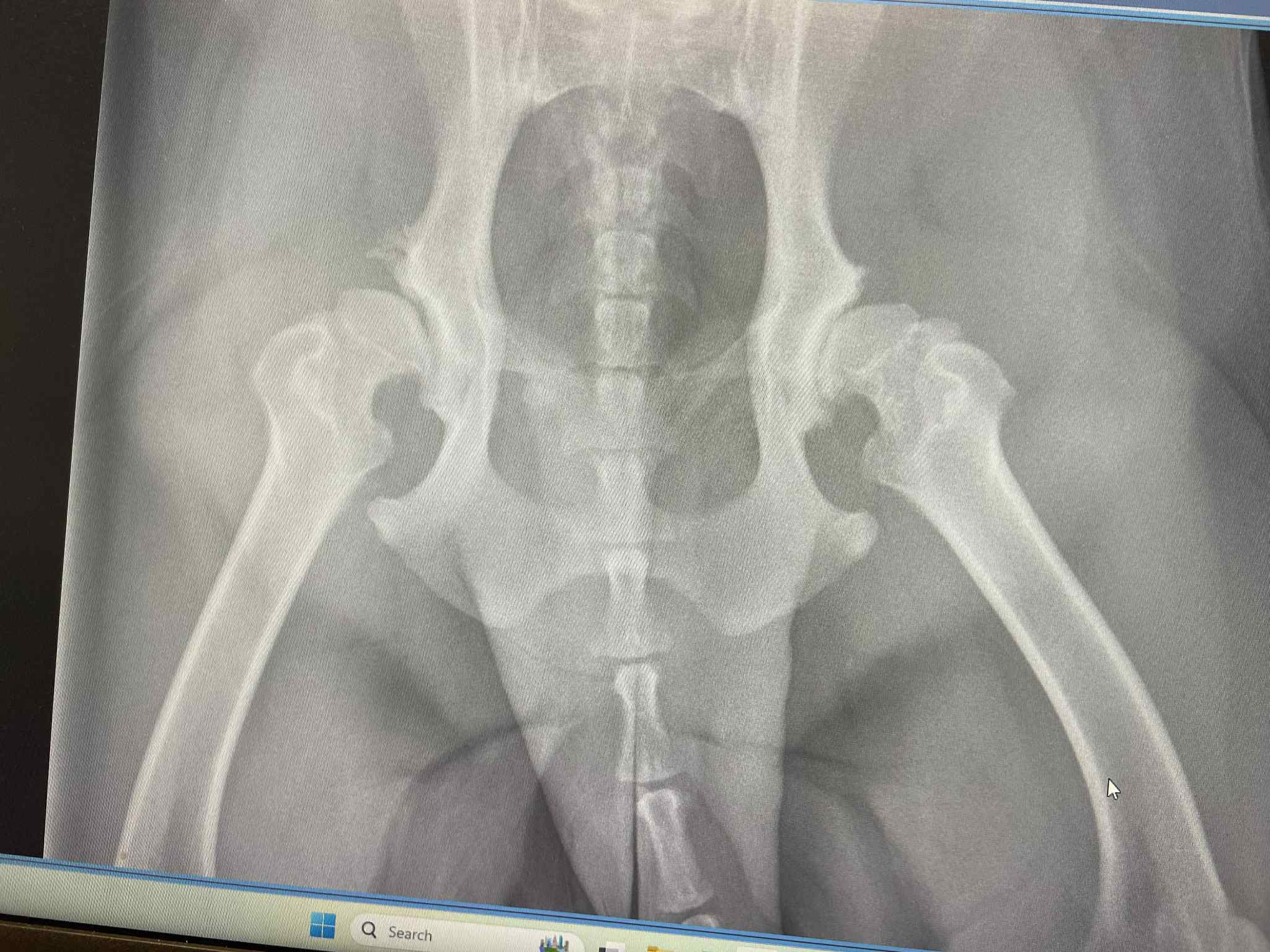 Help Save a Rescued Dog’s Leg After a Lifetime of Giving campaign photo, 5 of 8