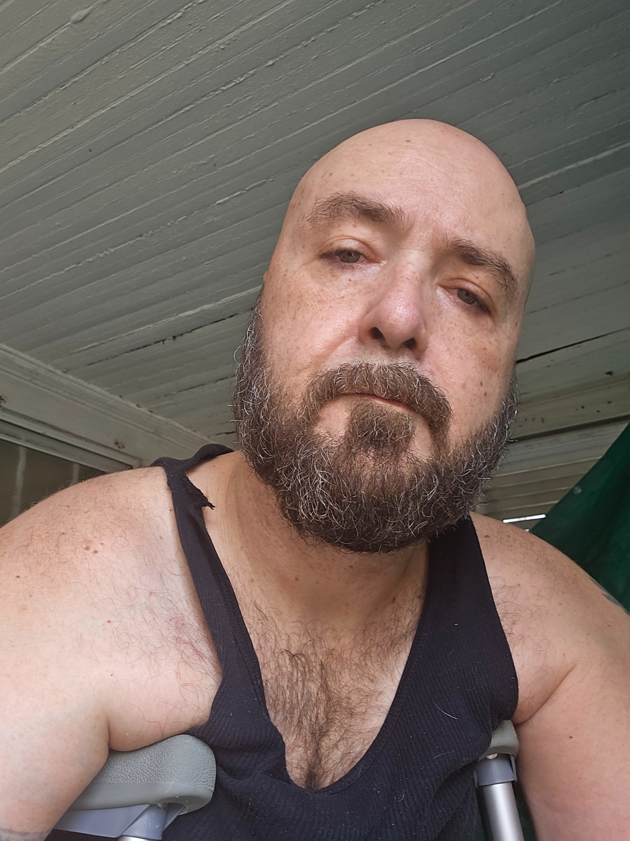 Needing some help financially after ankle surgery campaign photo, 4 of 7
