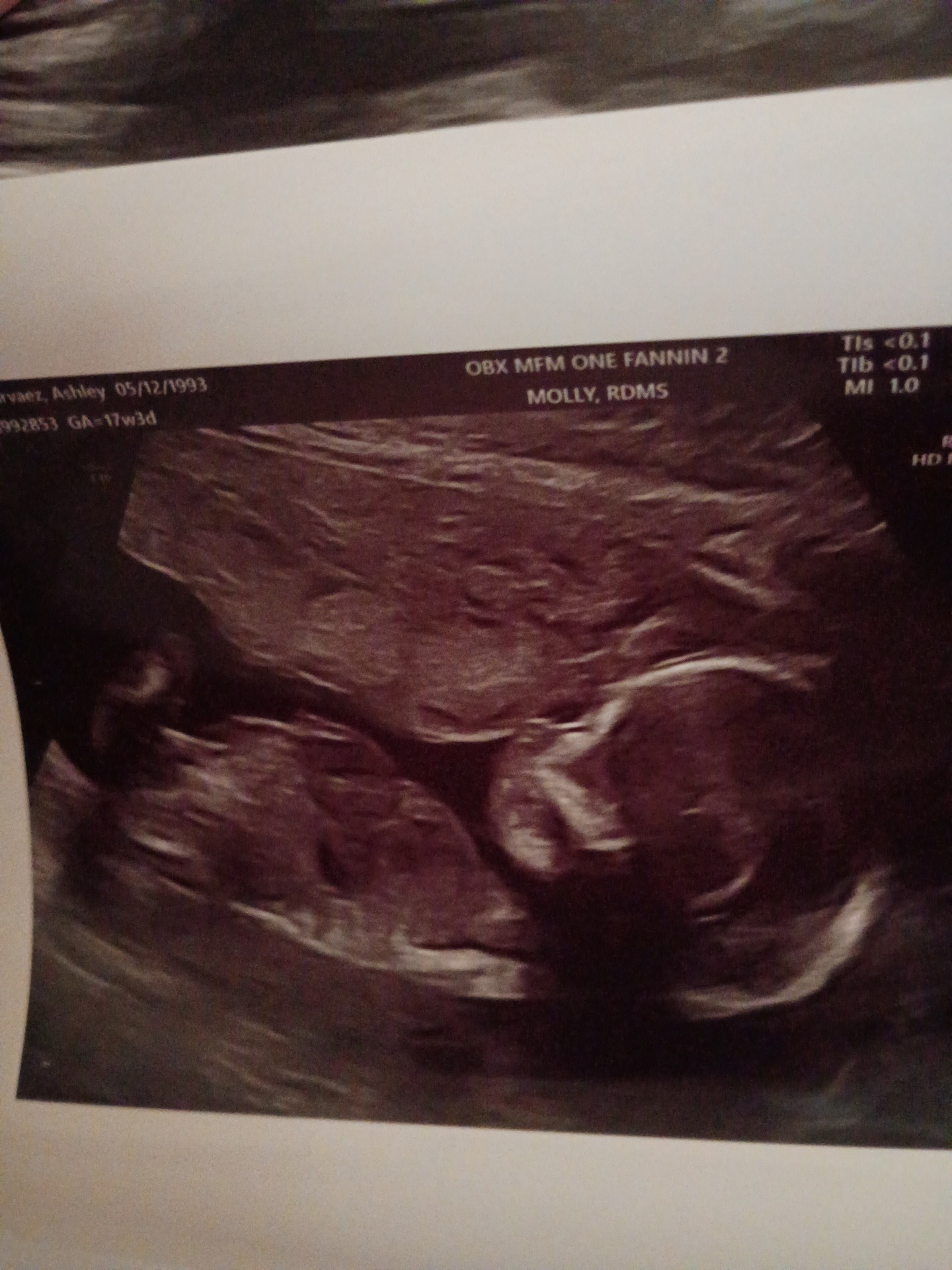 Support for Baby Jack Jack's Cremation campaign photo, 2 of 5