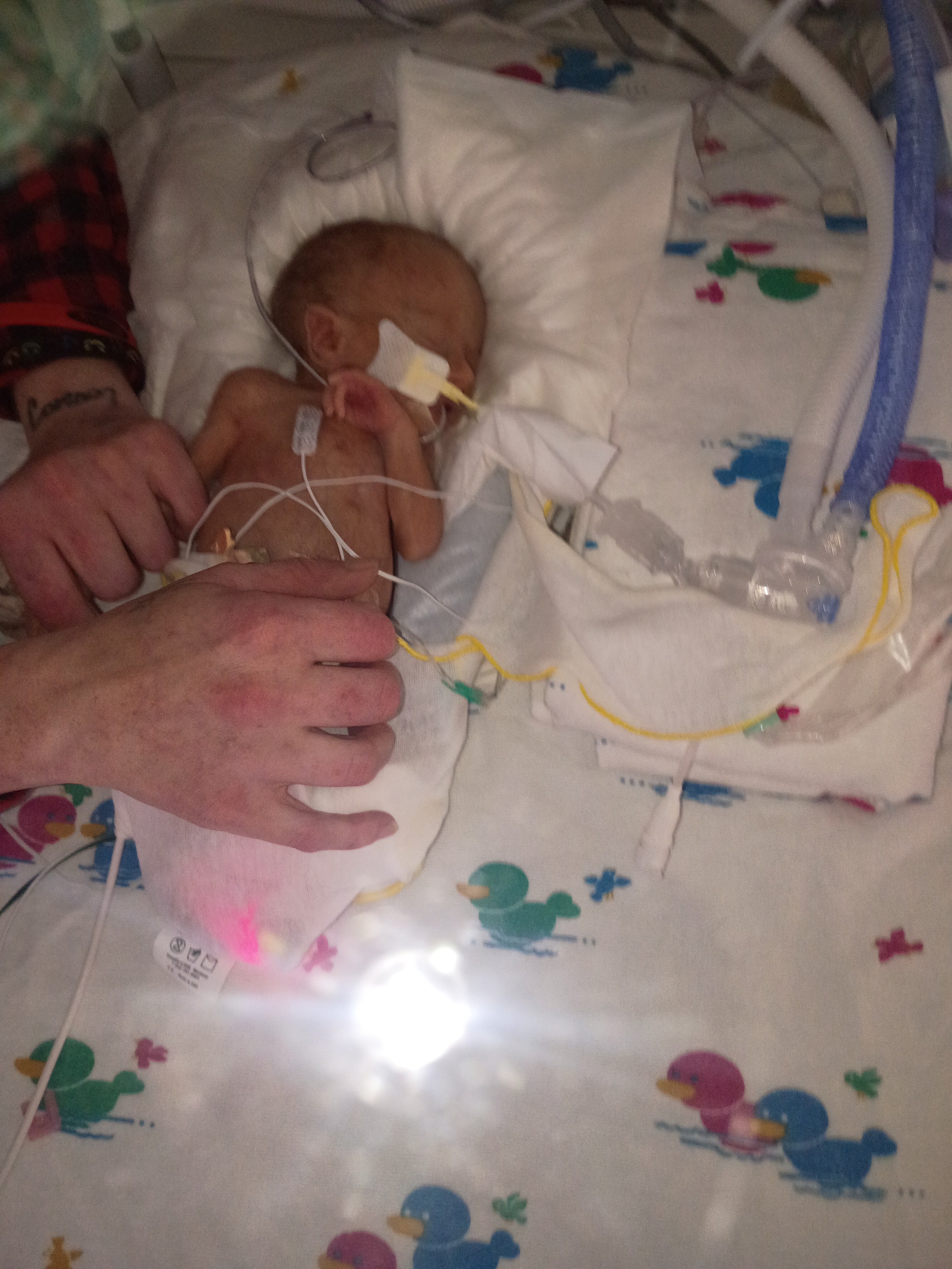 Support Mallory and Macy's NICU Journey campaign photo, 2 of 5