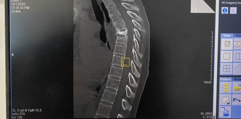 Mom needs an urgent back surgery campaign photo, 4 of 5