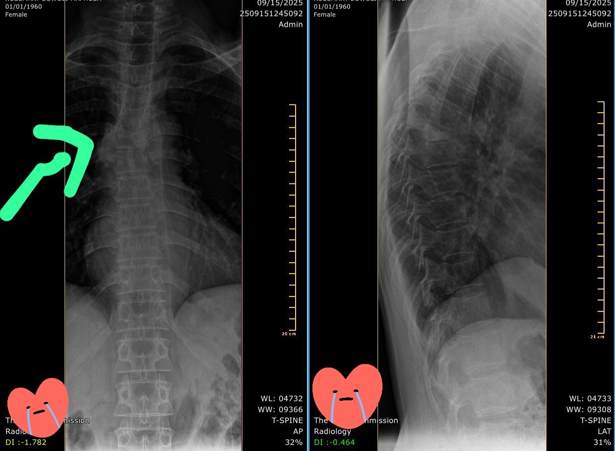 Mom needs an urgent back surgery campaign photo, 2 of 5