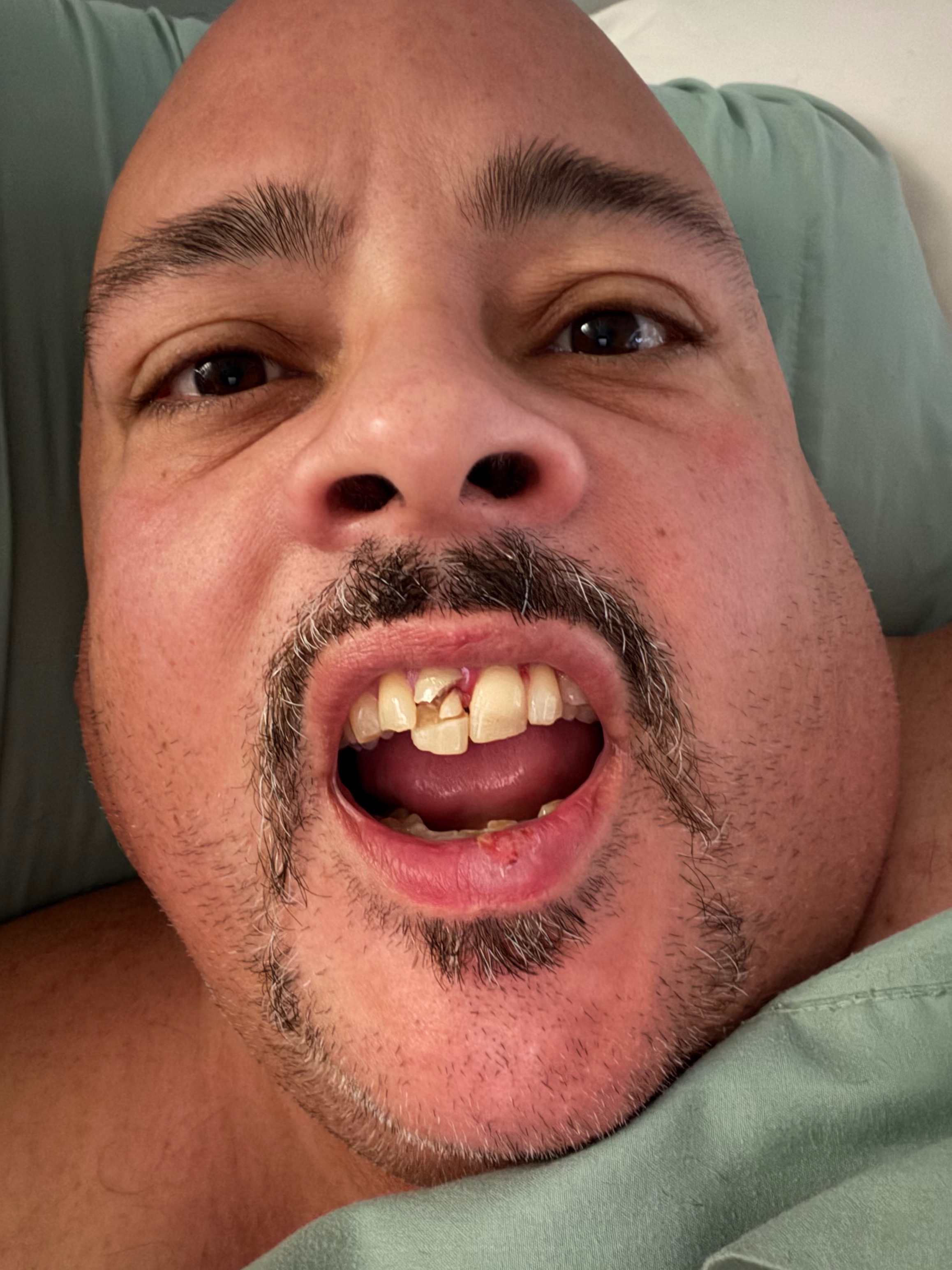 Support Javier's Urgent Dental Care campaign photo, 7 of 8