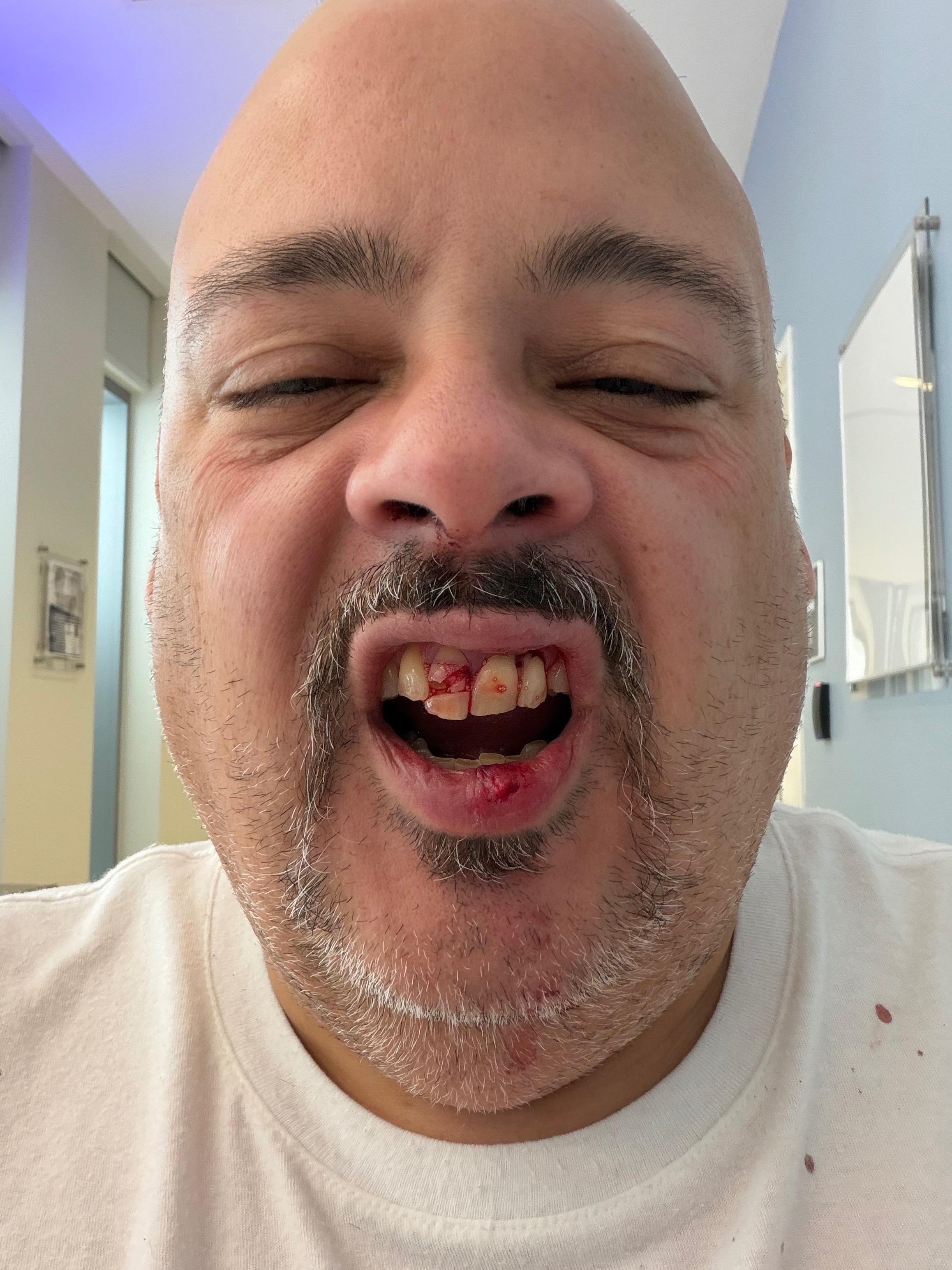 Support Javier's Urgent Dental Care campaign photo, 2 of 8