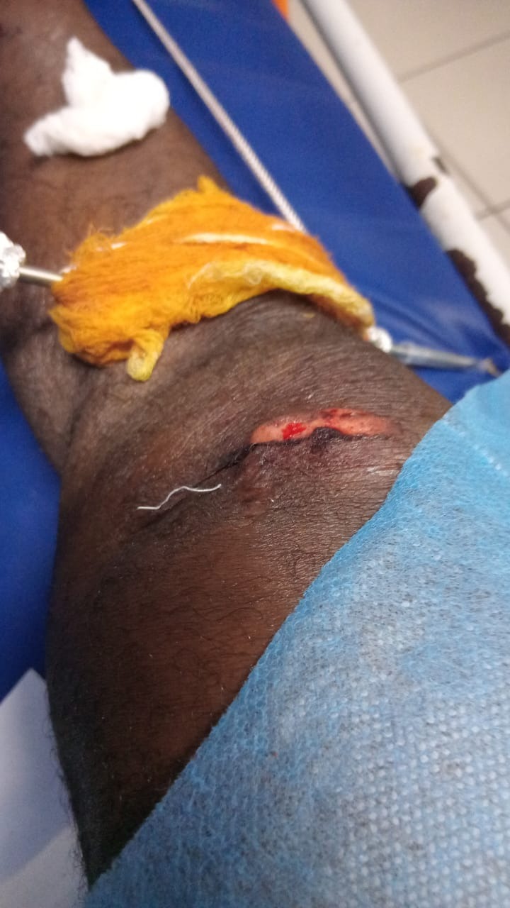 Help Ralston Heal: Urgent Surgery Needed campaign photo, 5 of 6