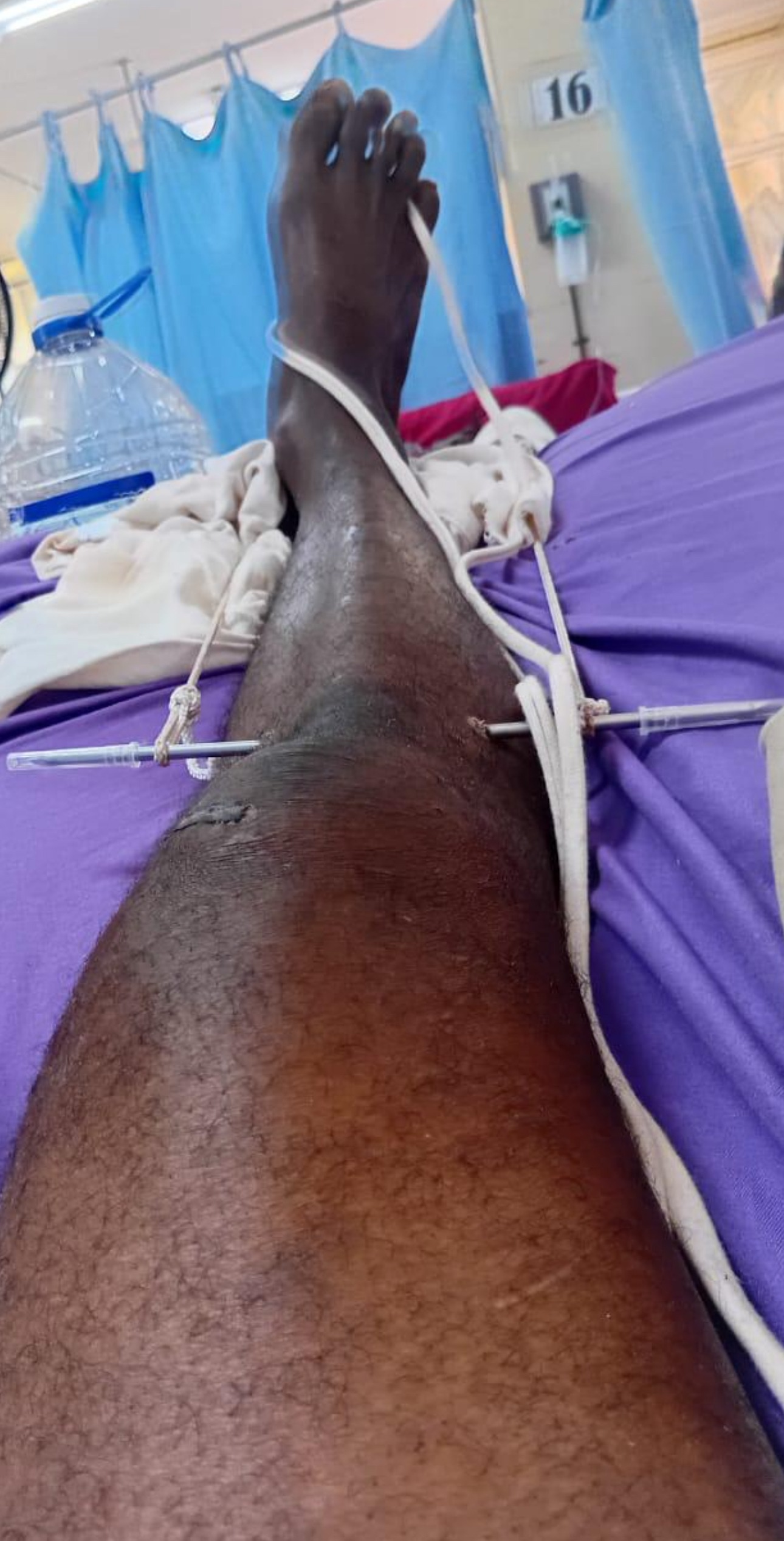 Help Ralston Heal: Urgent Surgery Needed campaign photo, 2 of 6