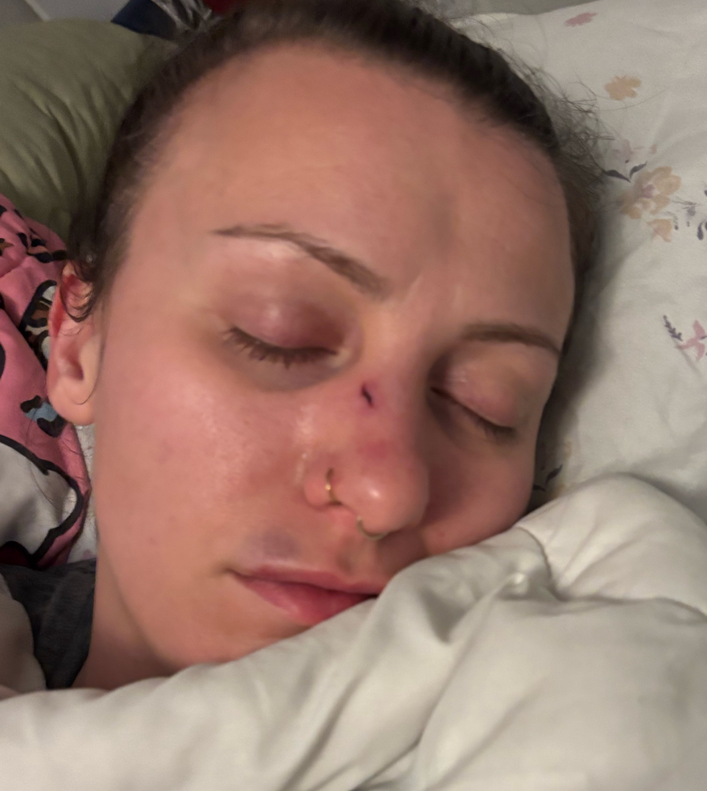 Help Leticia and Abigail Heal from Brutal Attack campaign photo, 4 of 7