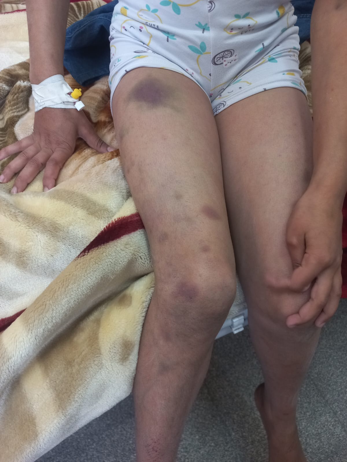 Donate for Gaza Child's Critical Treatment campaign photo, 5 of 8