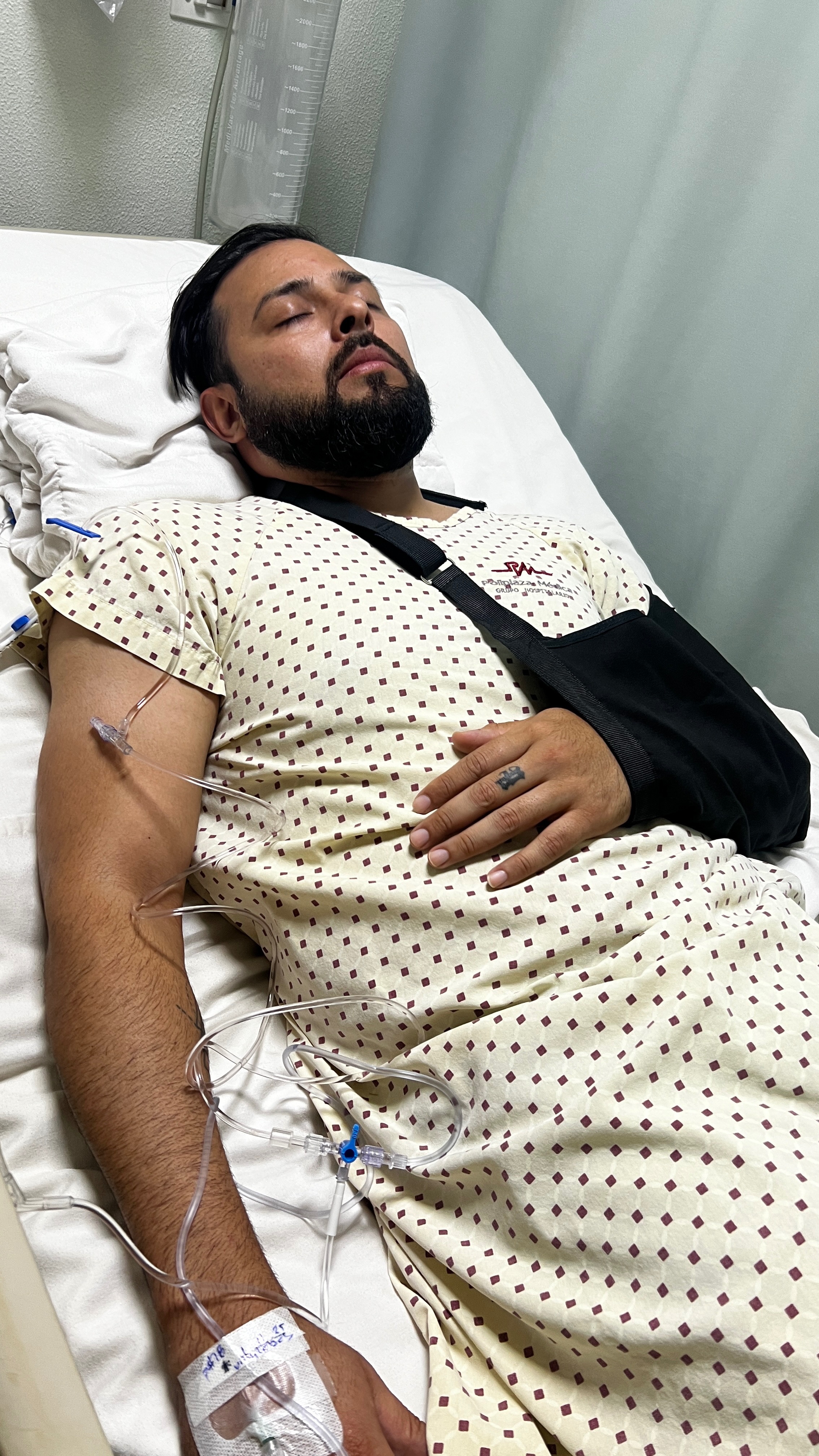Fractura de clavícula campaign photo, 4 of 5