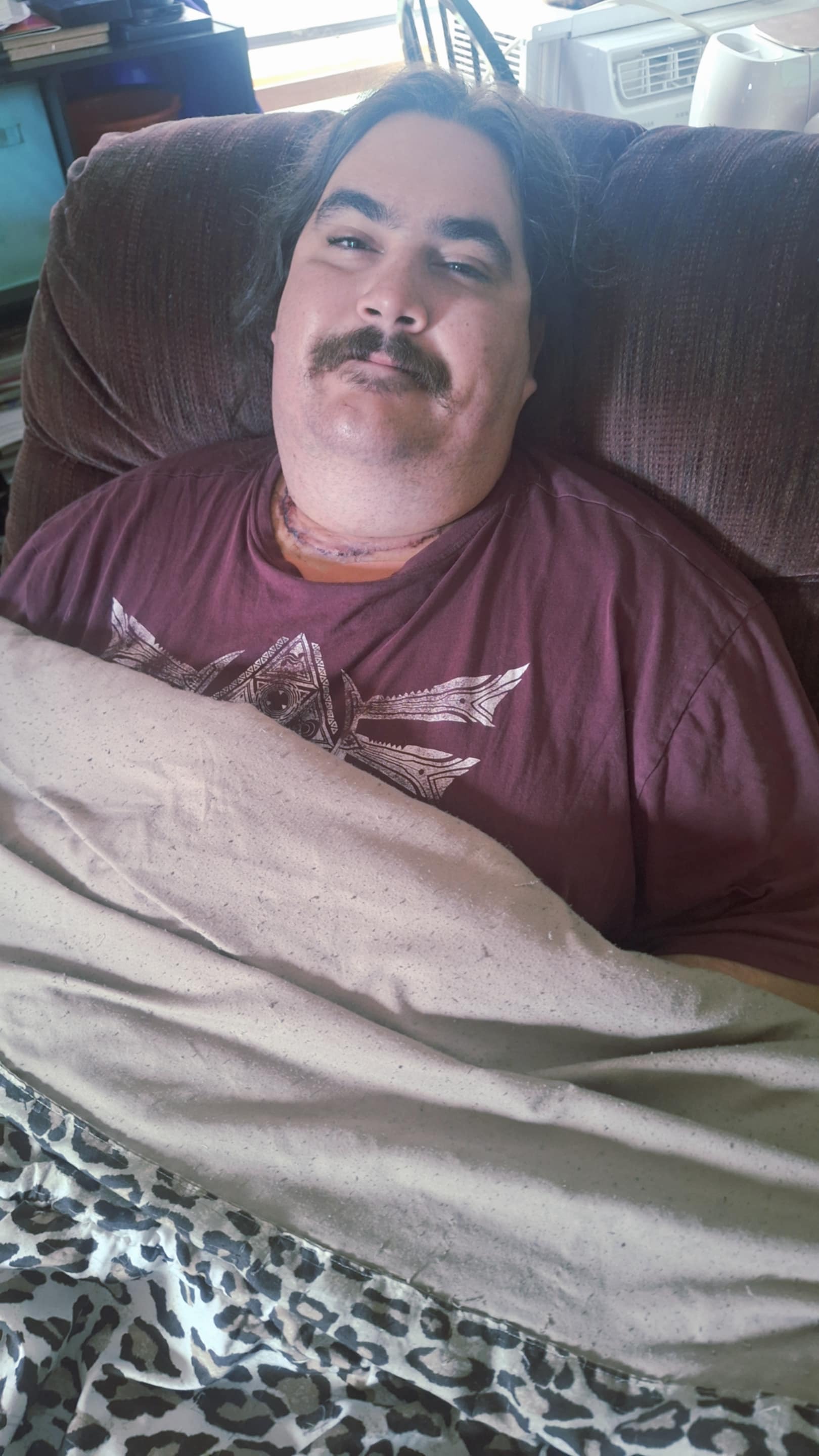 help Shawn with recover after thyroid cancer surgery campaign photo, 2 of 4