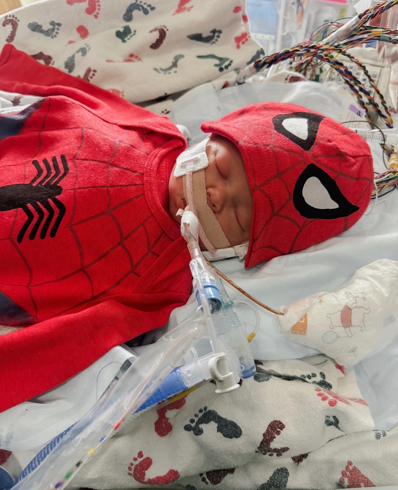 Support Baby Huck's Fight Against OTC Deficiency campaign photo, 2 of 4