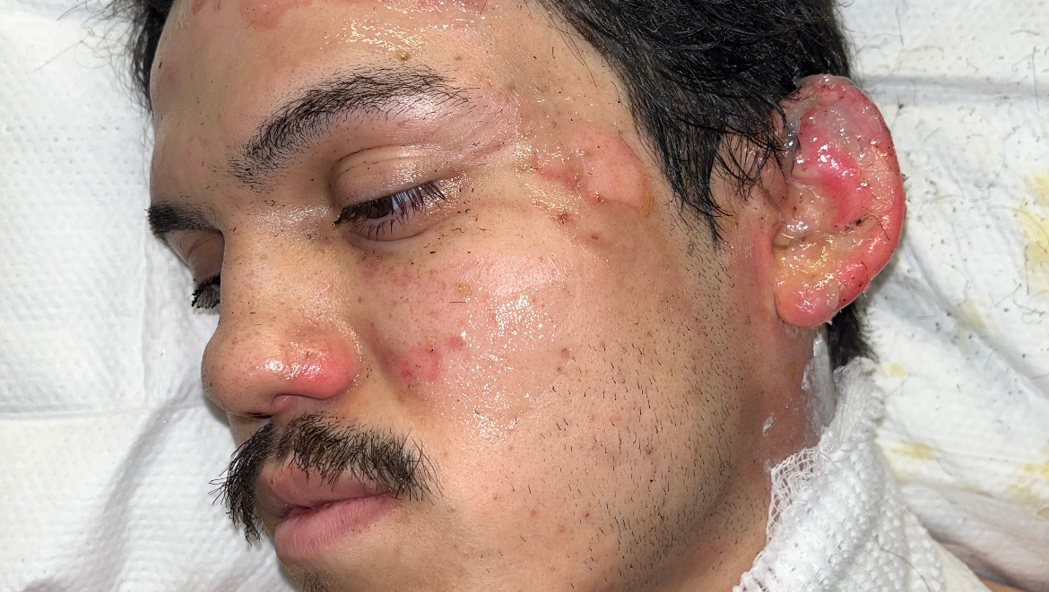 Support Eric and Eli's Medical expenses photo