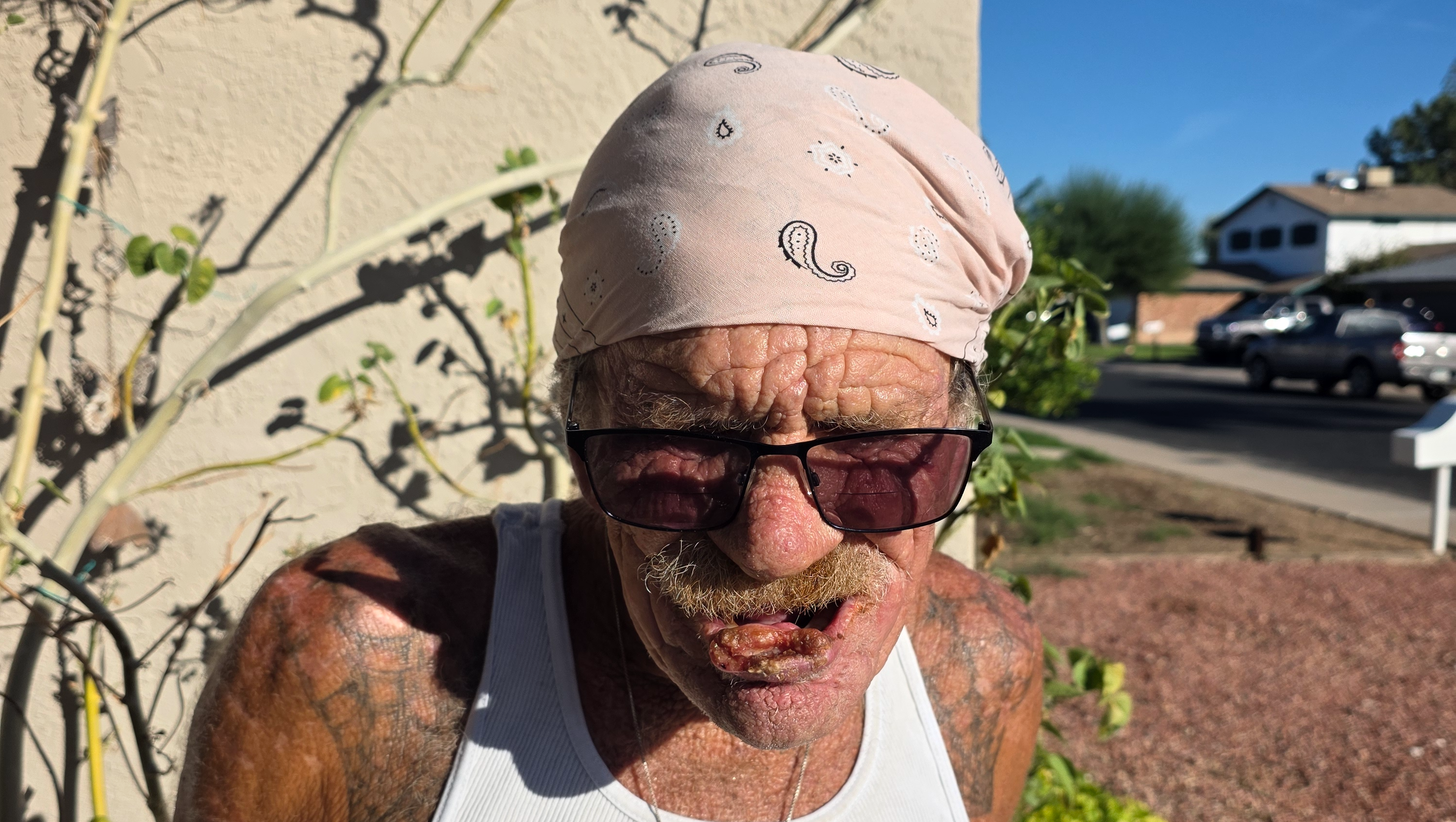 Fundraiser by Justin Butler : Support Melvin's Fight Against Skin Cancer