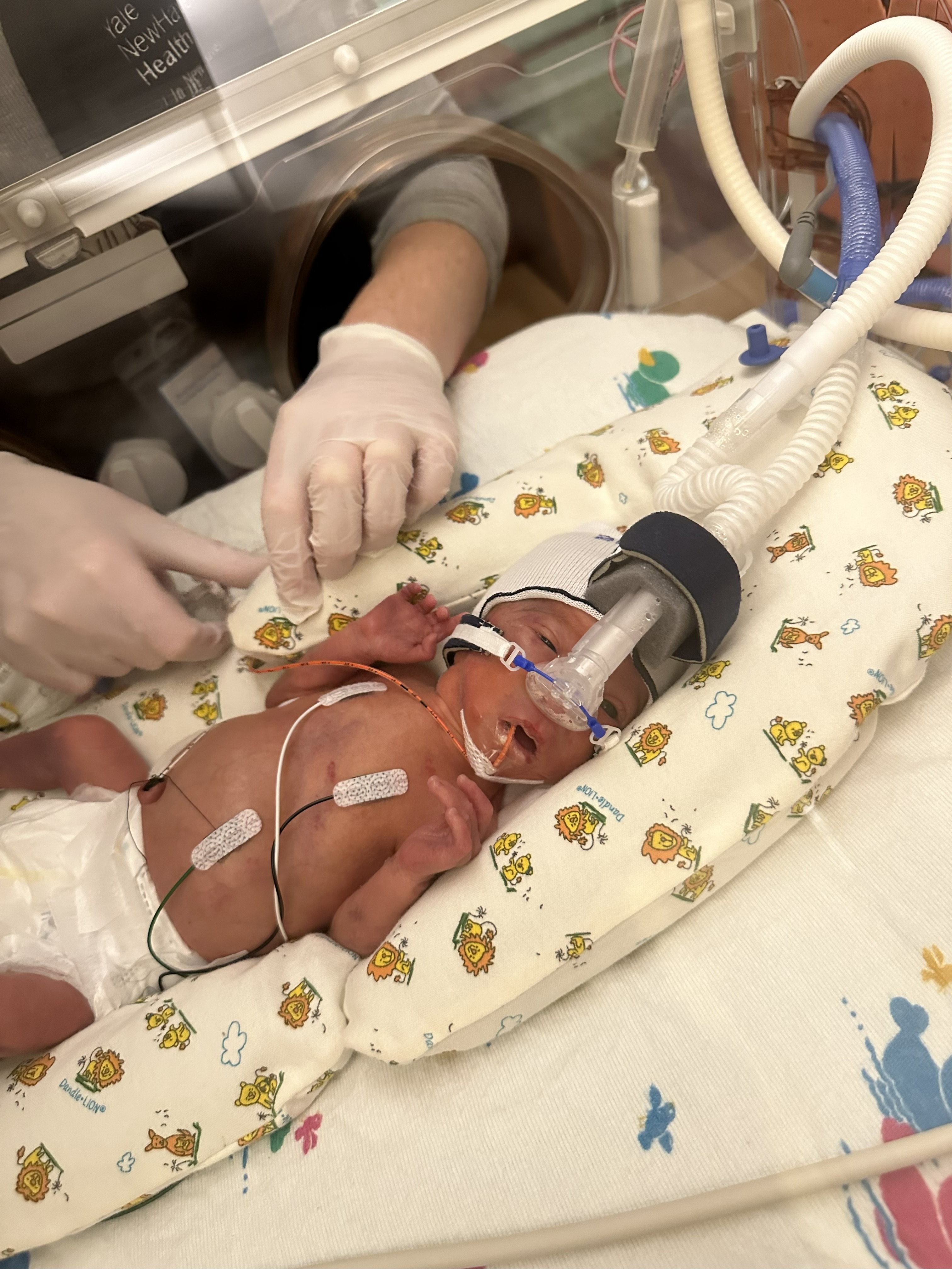 With Faith and Hope for Baby Niko’s Recovery campaign photo, 2 of 4