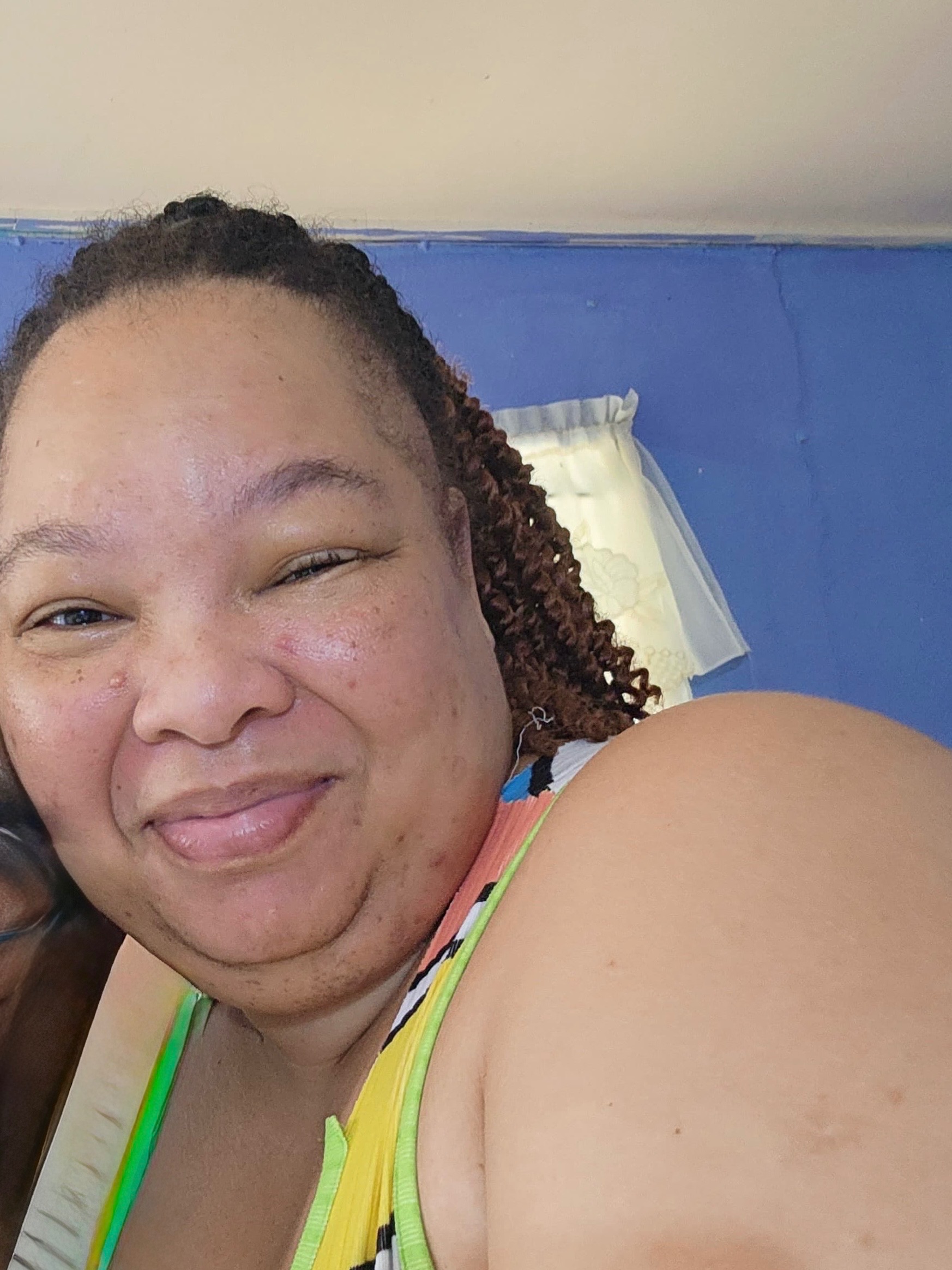 Emergency Aid for my BLIND AND DIABETIC cousin campaign photo, 2 of 7