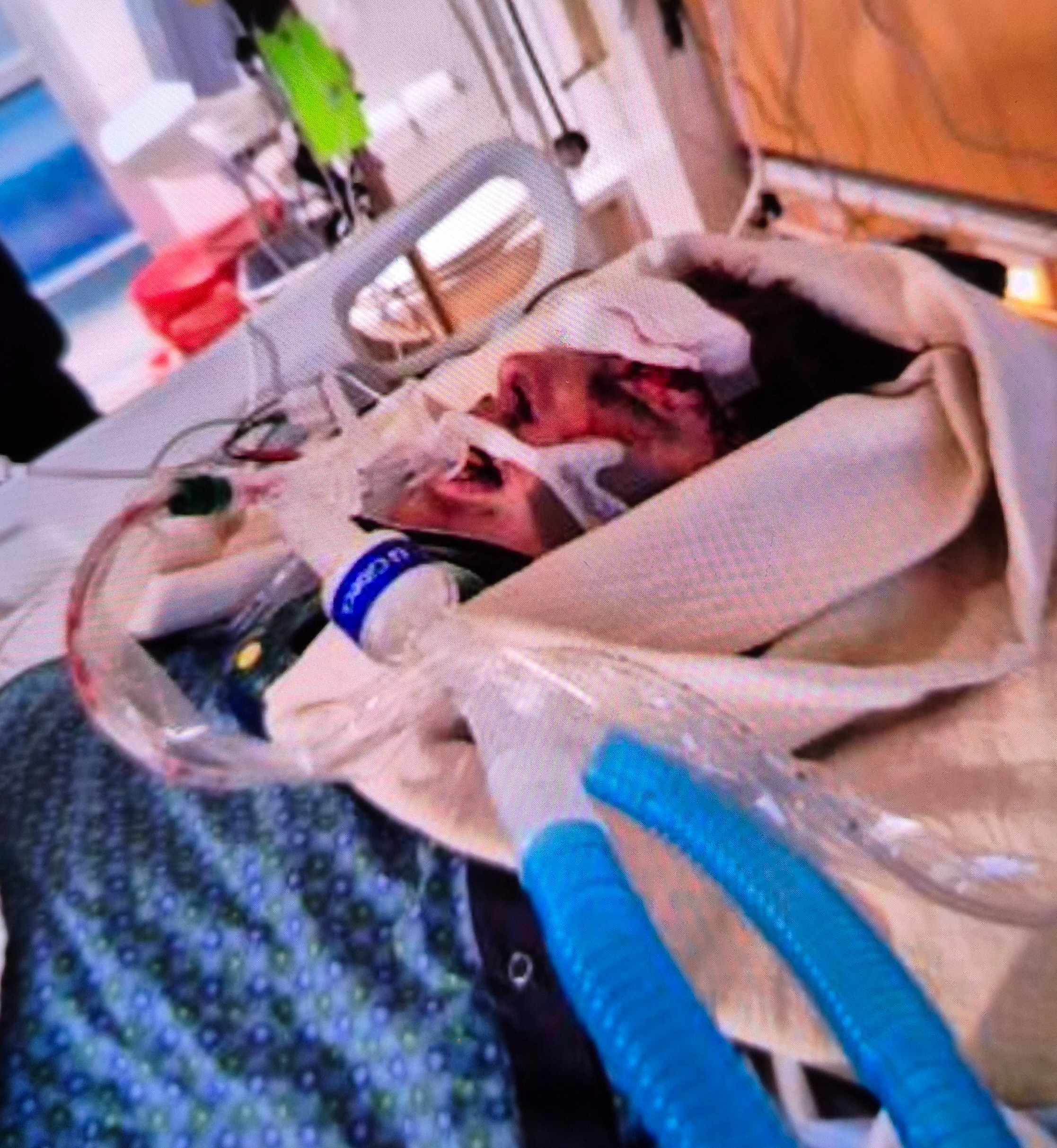 Support Trent's Long Road to Recovery campaign photo, 2 of 5
