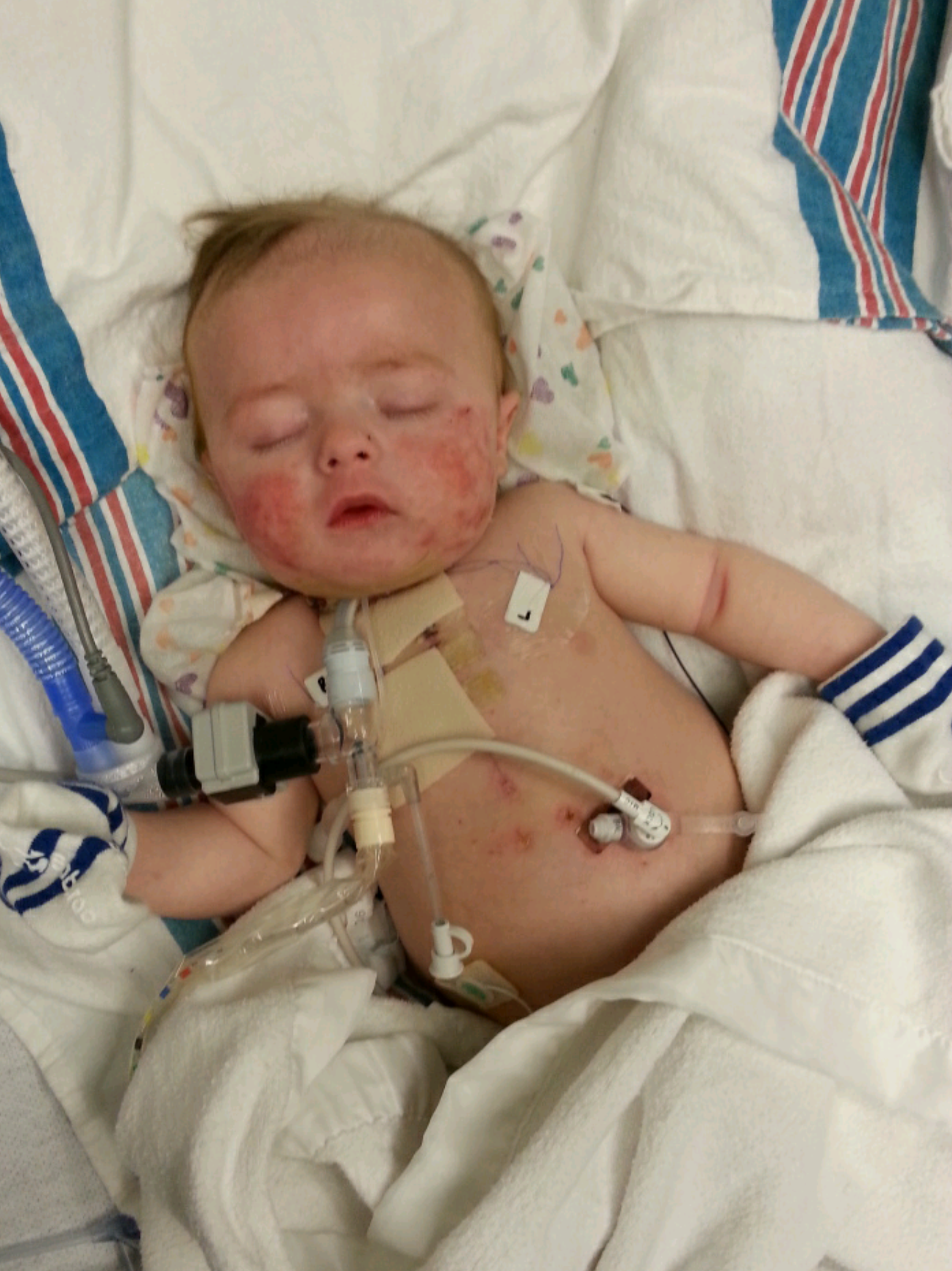 Support King’s Second Heart Surgery campaign photo, 4 of 7