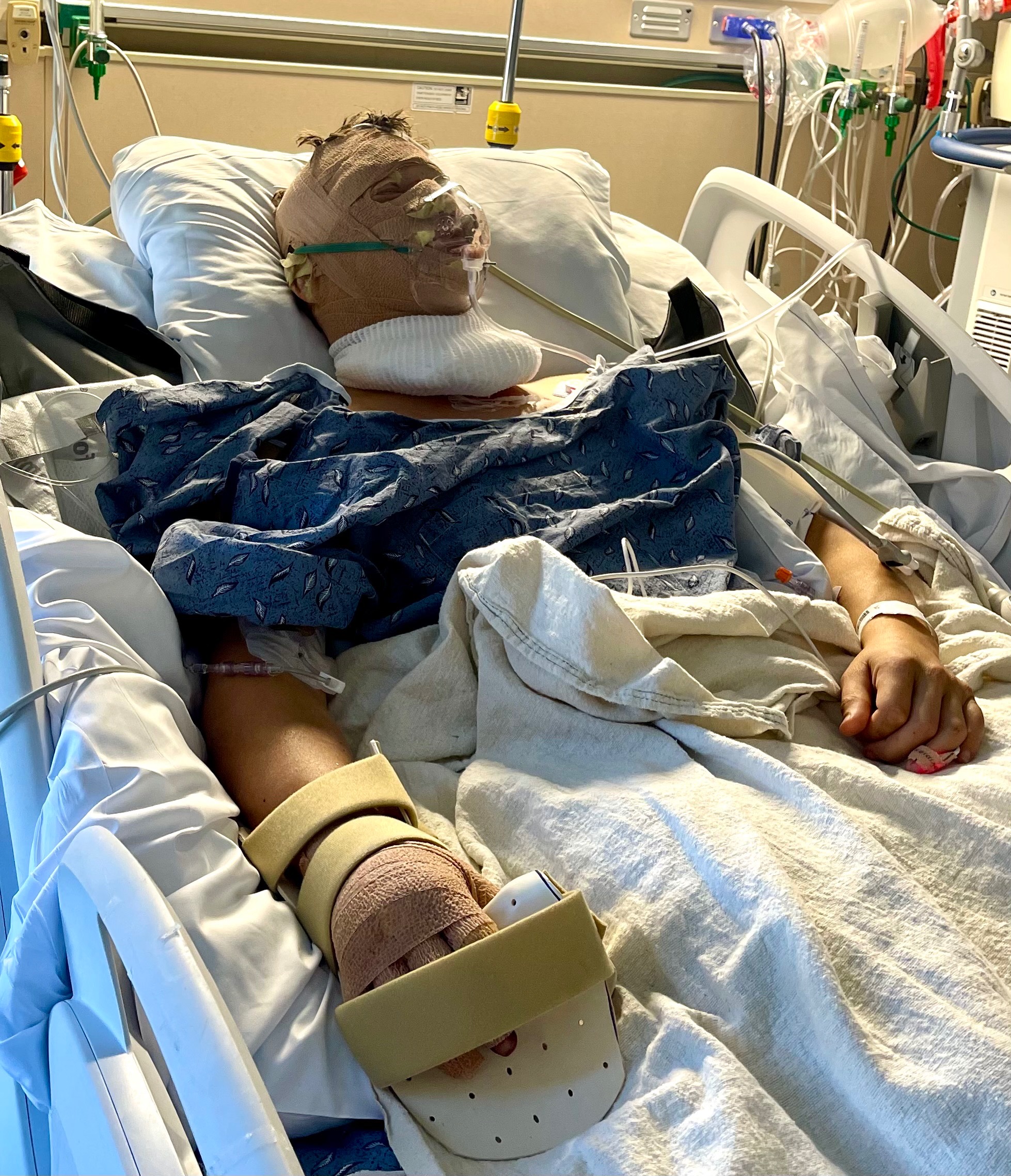 Support Andrew's Recovery from Severe Burns campaign photo, 6 of 7