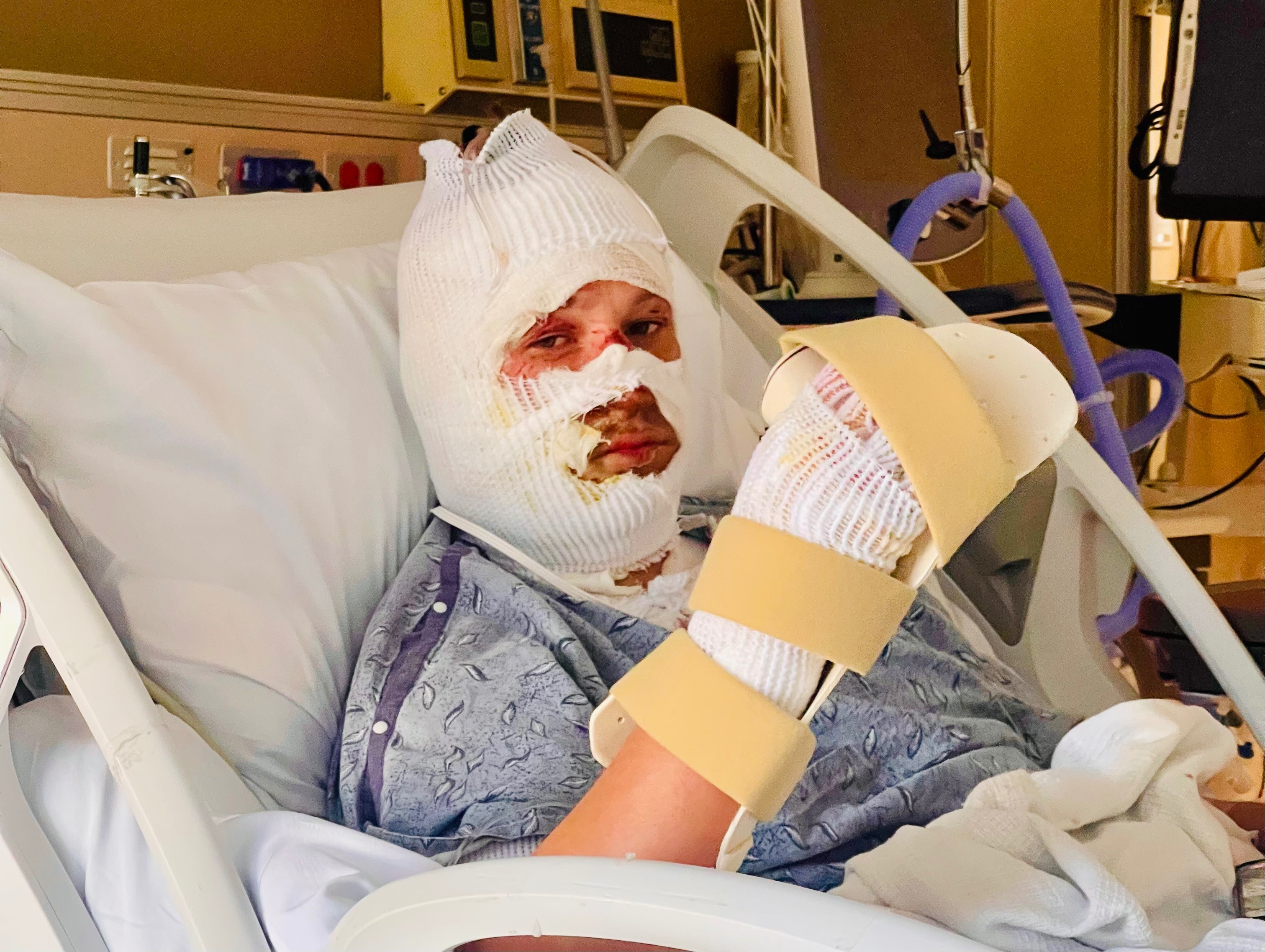 Support Andrew's Recovery from Severe Burns campaign photo, 5 of 7