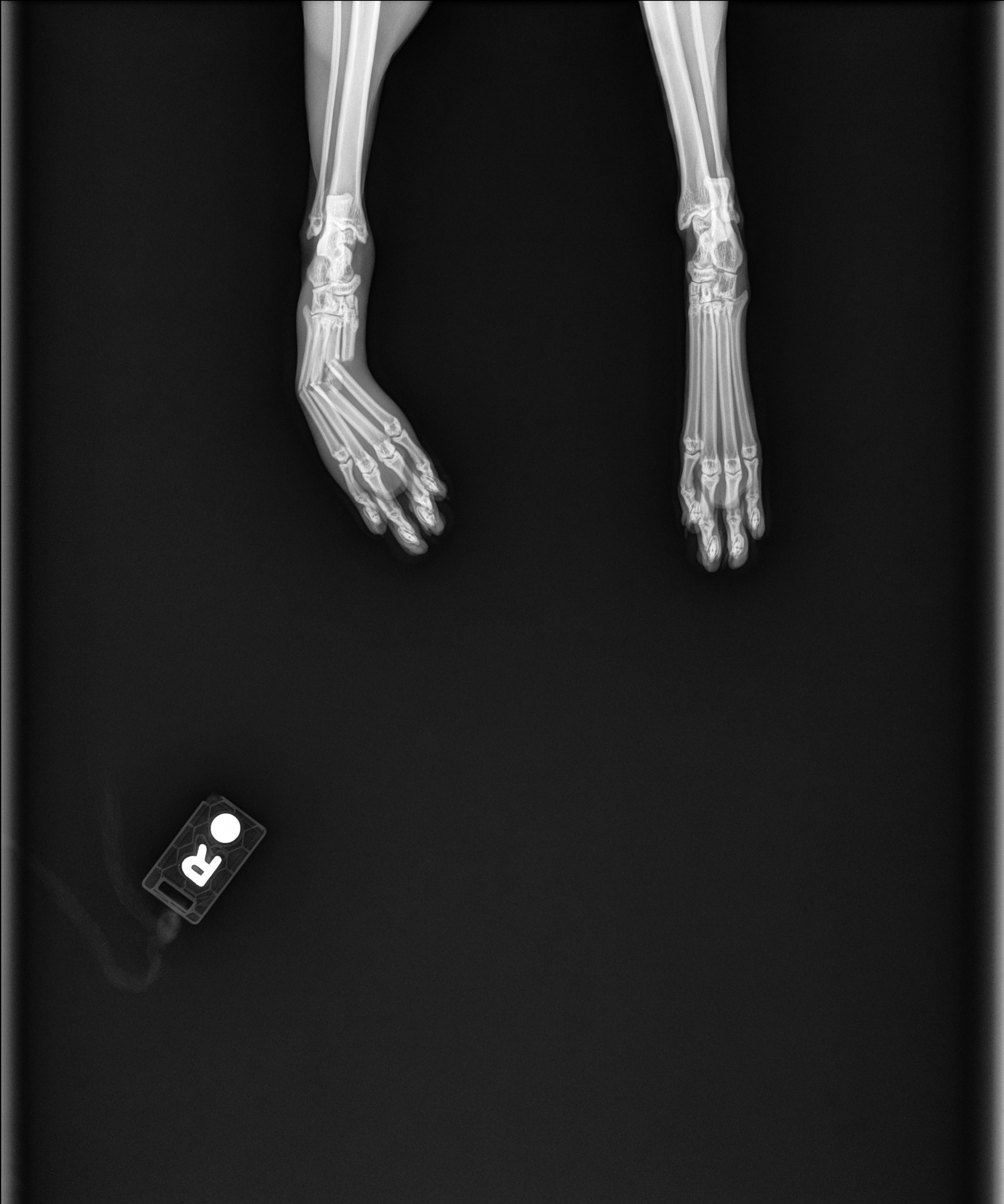 Save Oli's Leg: Urgent Surgery Needed campaign photo, 7 of 8