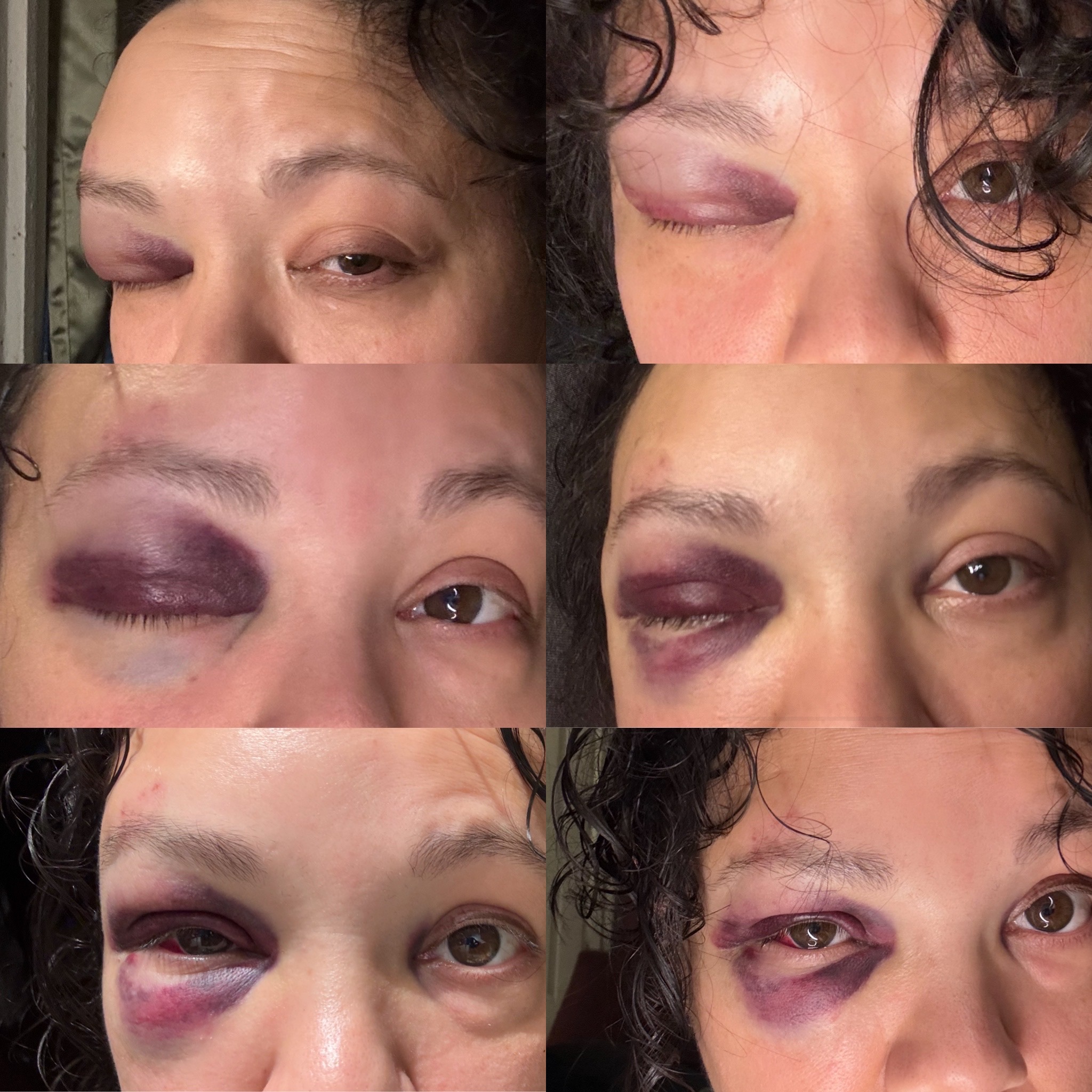 Support needed for accident recovery and missed work campaign photo, 5 of 6