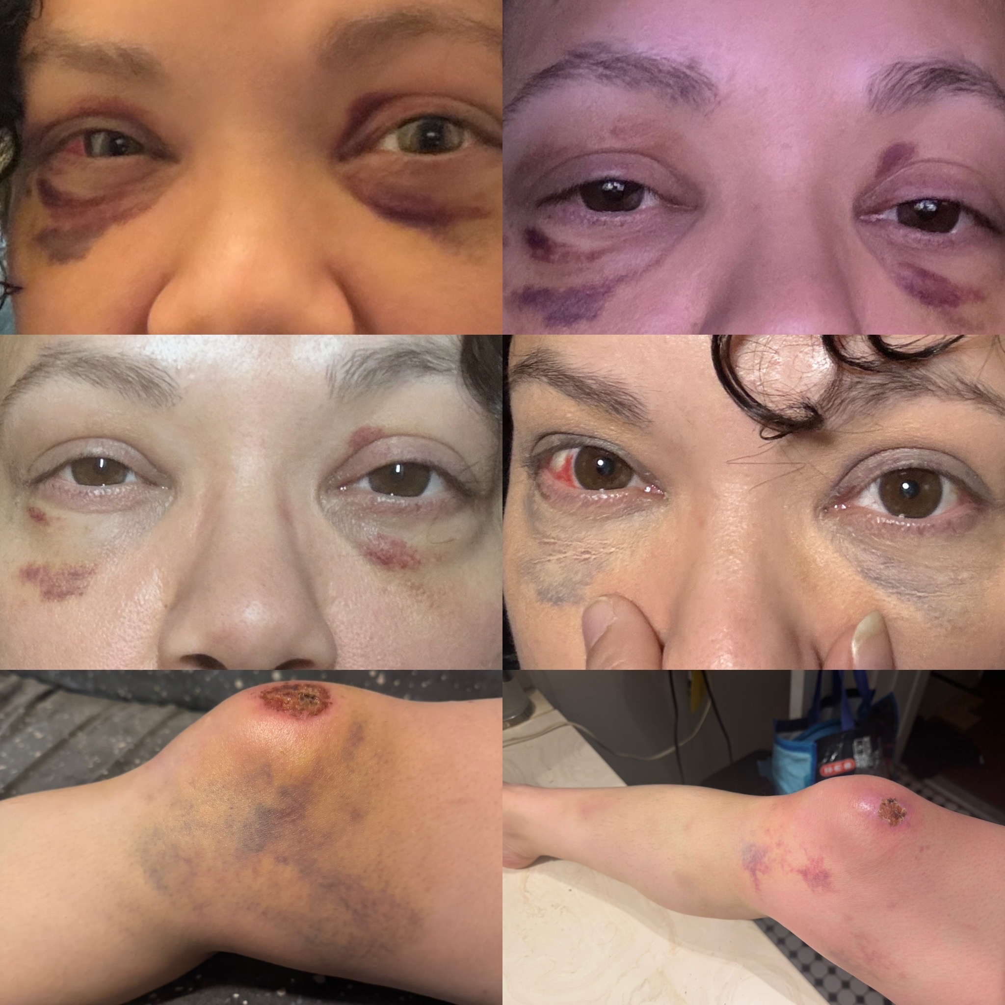 Support needed for accident recovery and missed work campaign photo, 4 of 6