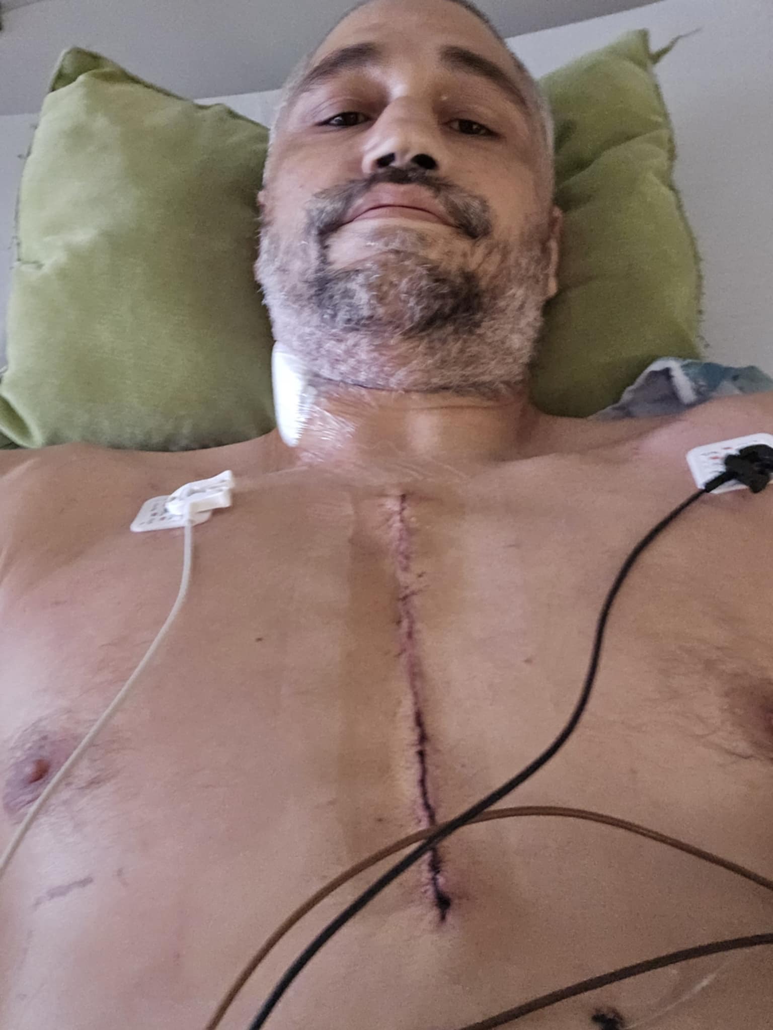 Soutien pour Martin, 42 ans — Opération à cœur ouvert campaign photo, 4 of 7