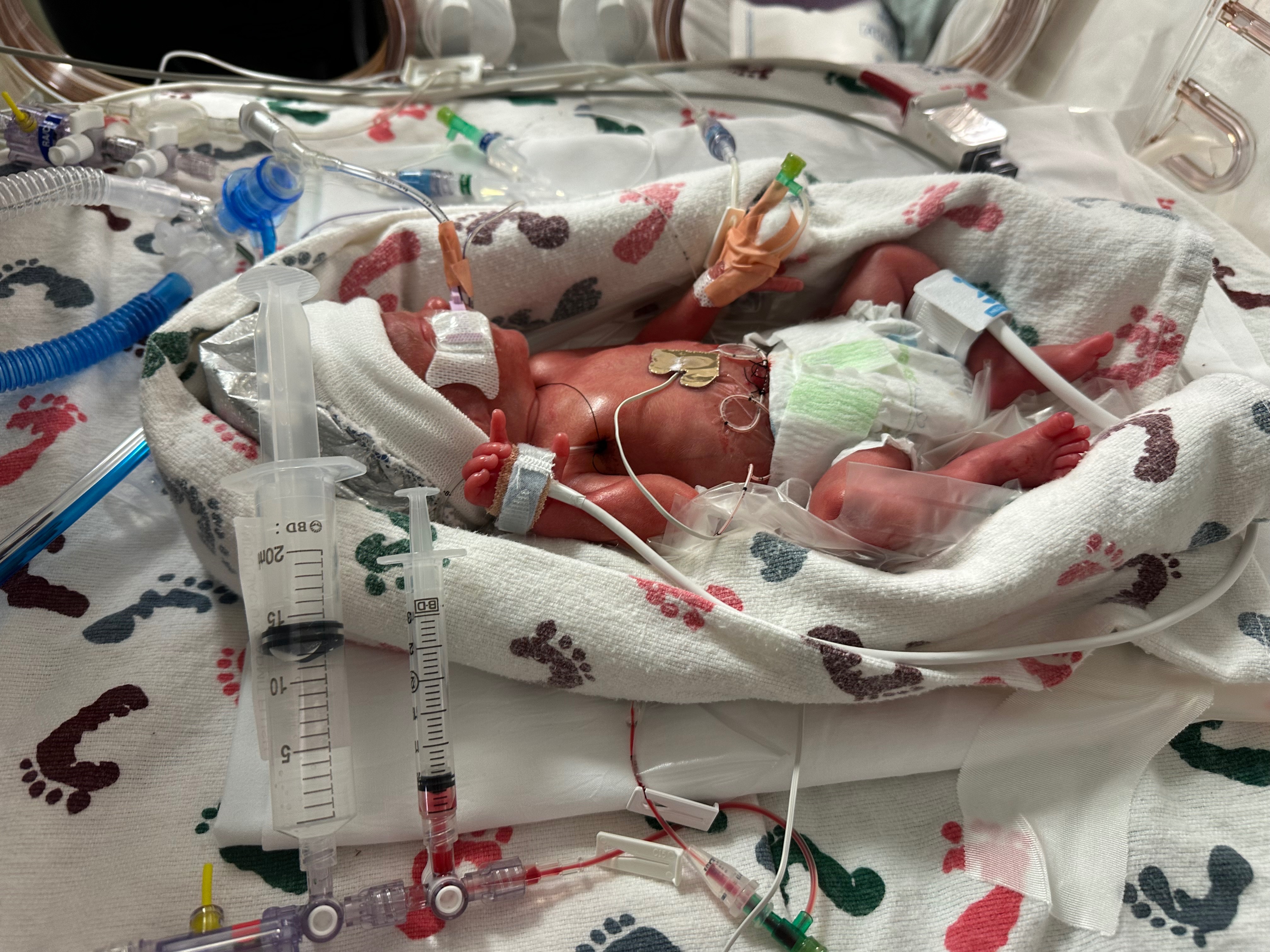 Support Baby Clark's NICU Journey campaign photo, 2 of 5