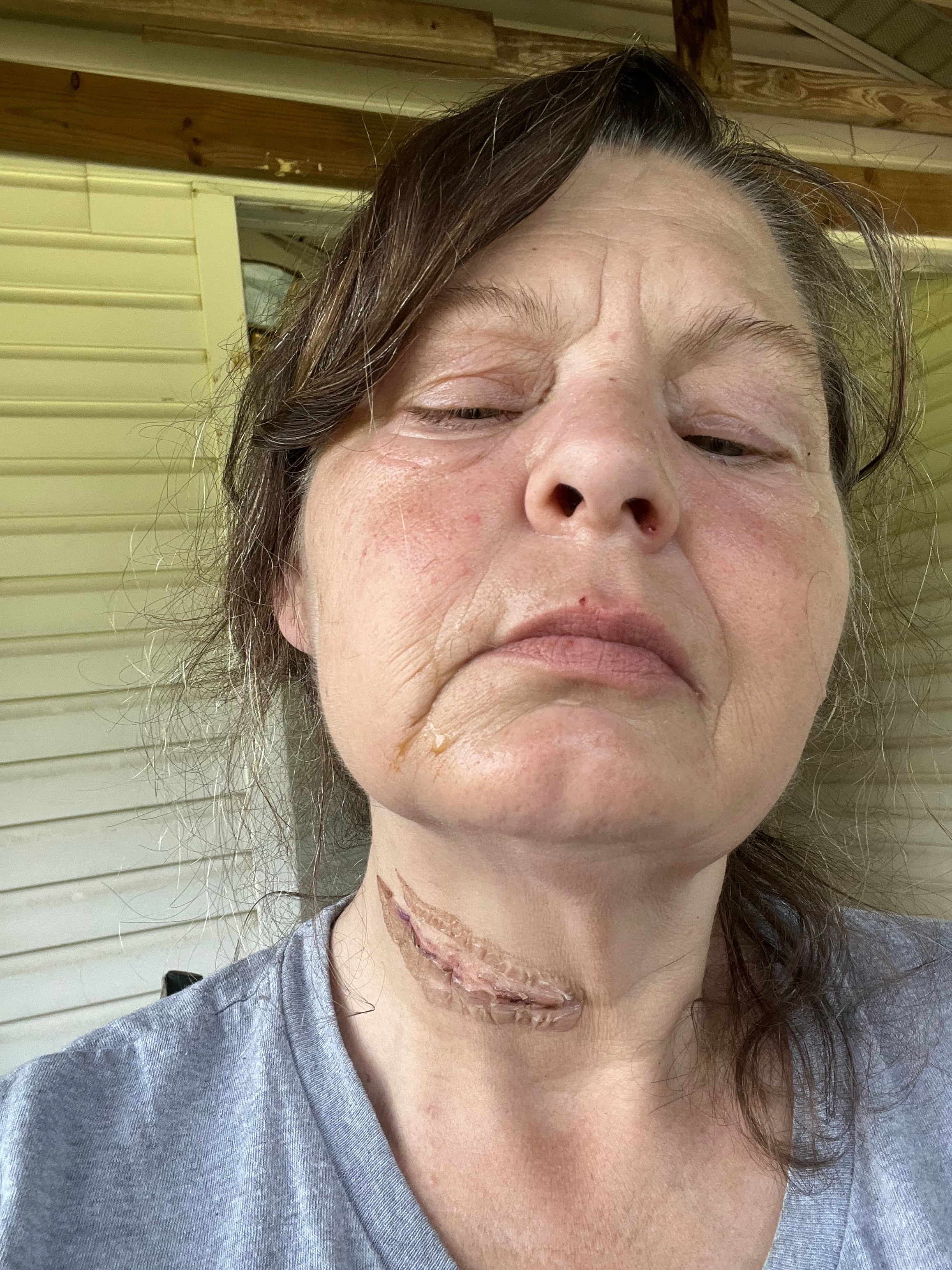 Donate to Keep Christy Reynolds' Family Together campaign photo, 2 of 6