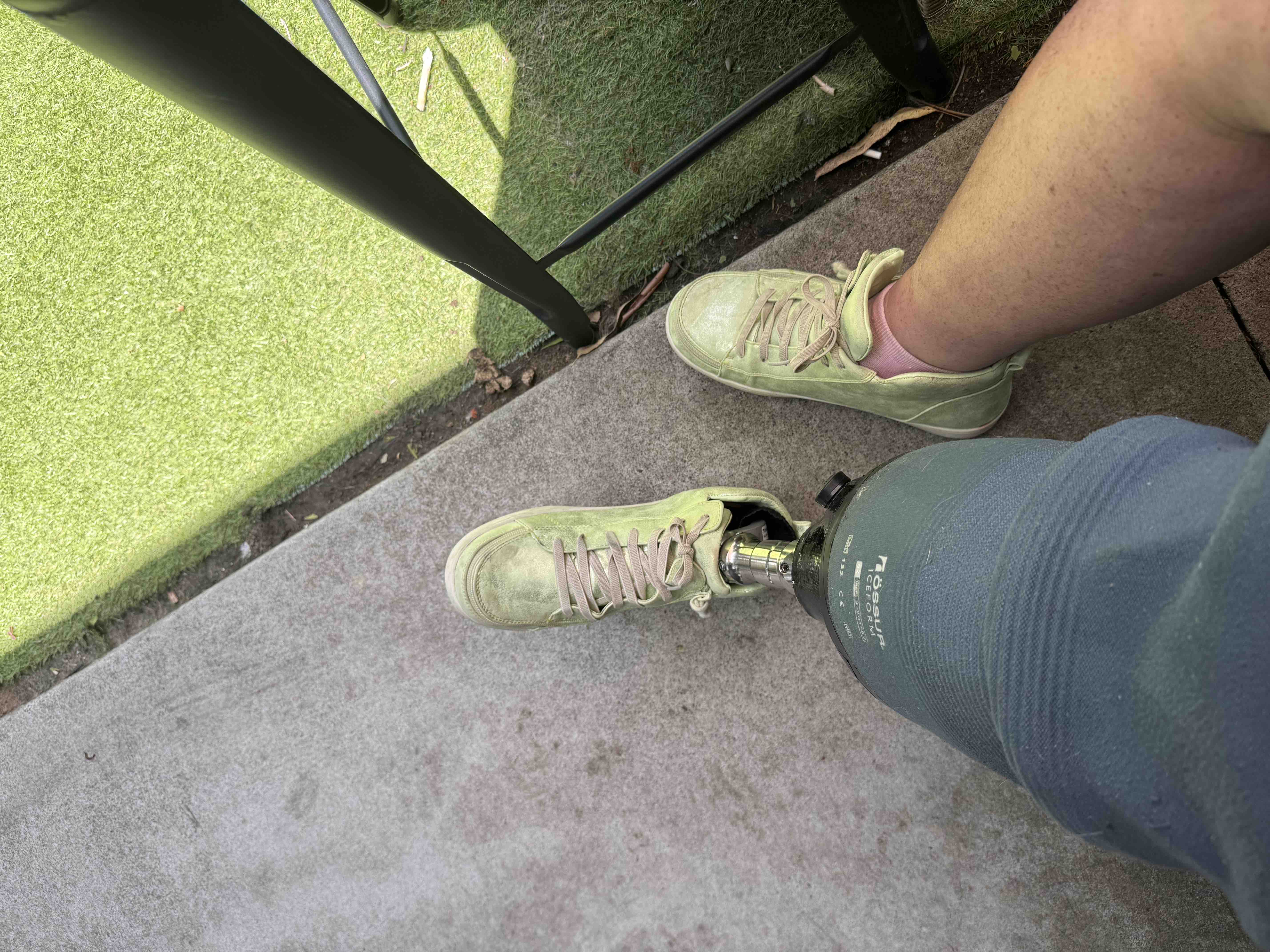Leg Amputation leaves Kiwi broke in Aussie campaign photo, 2 of 4