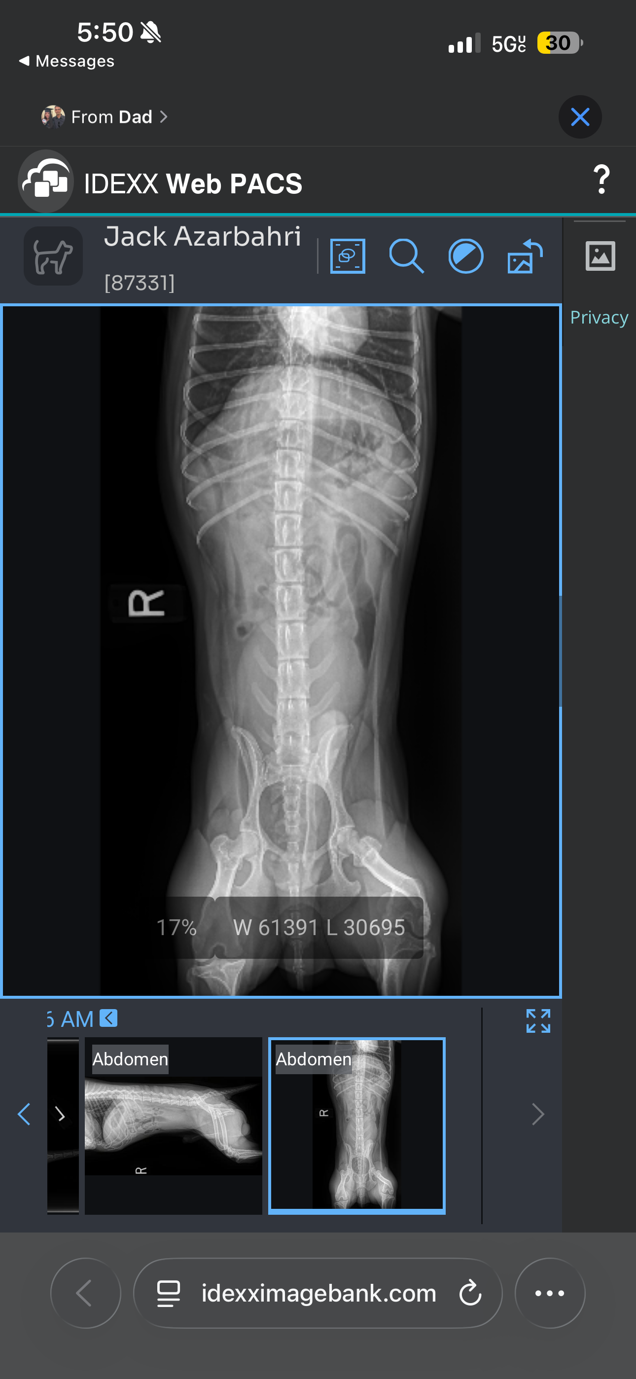 Help Jack Get Life-Saving Surgery campaign photo, 4 of 7