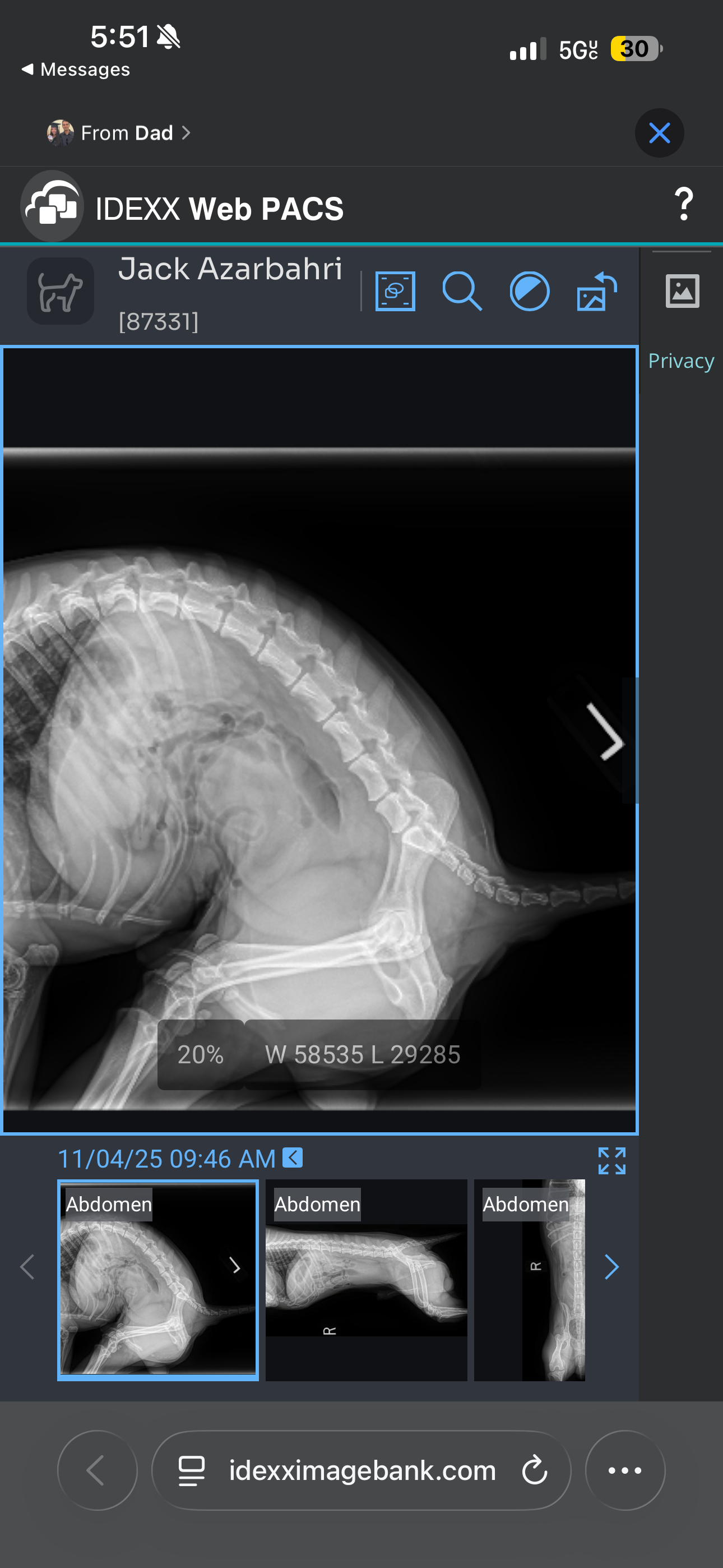 Help Jack Get Life-Saving Surgery campaign photo, 5 of 7