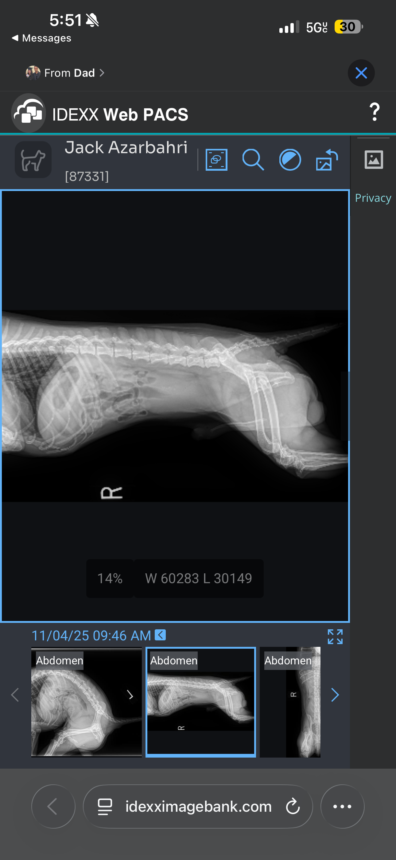 Help Jack Get Life-Saving Surgery campaign photo, 2 of 7